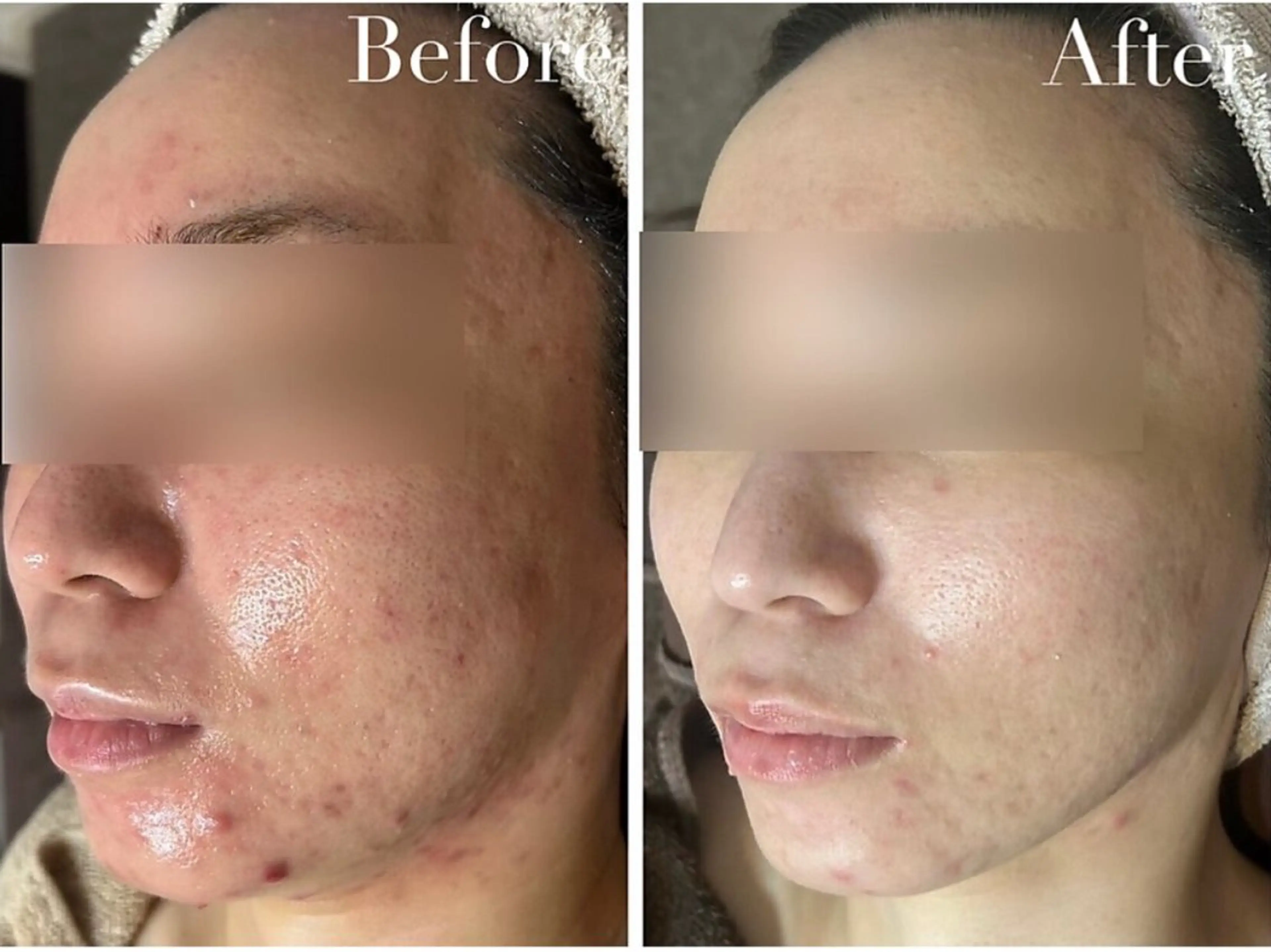 エステ Avenir Brillant所属・松田 紗季のエステ・リラクイメージ