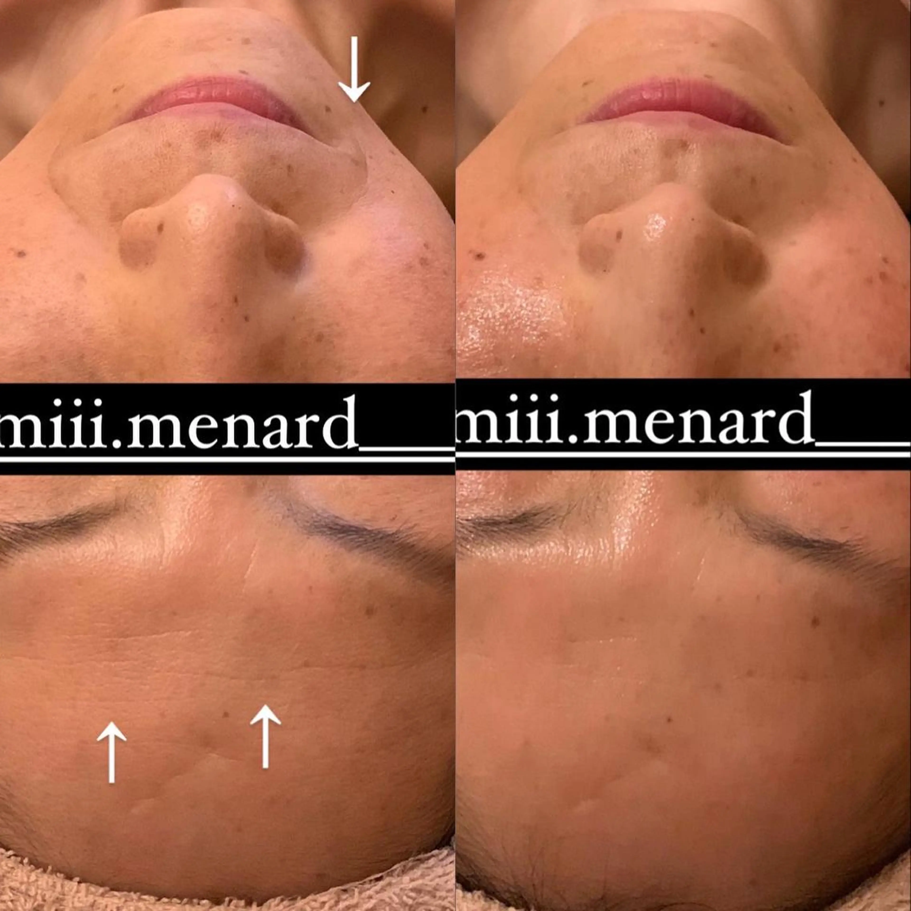 MENARD mikacoのエステ・リラクイメージ