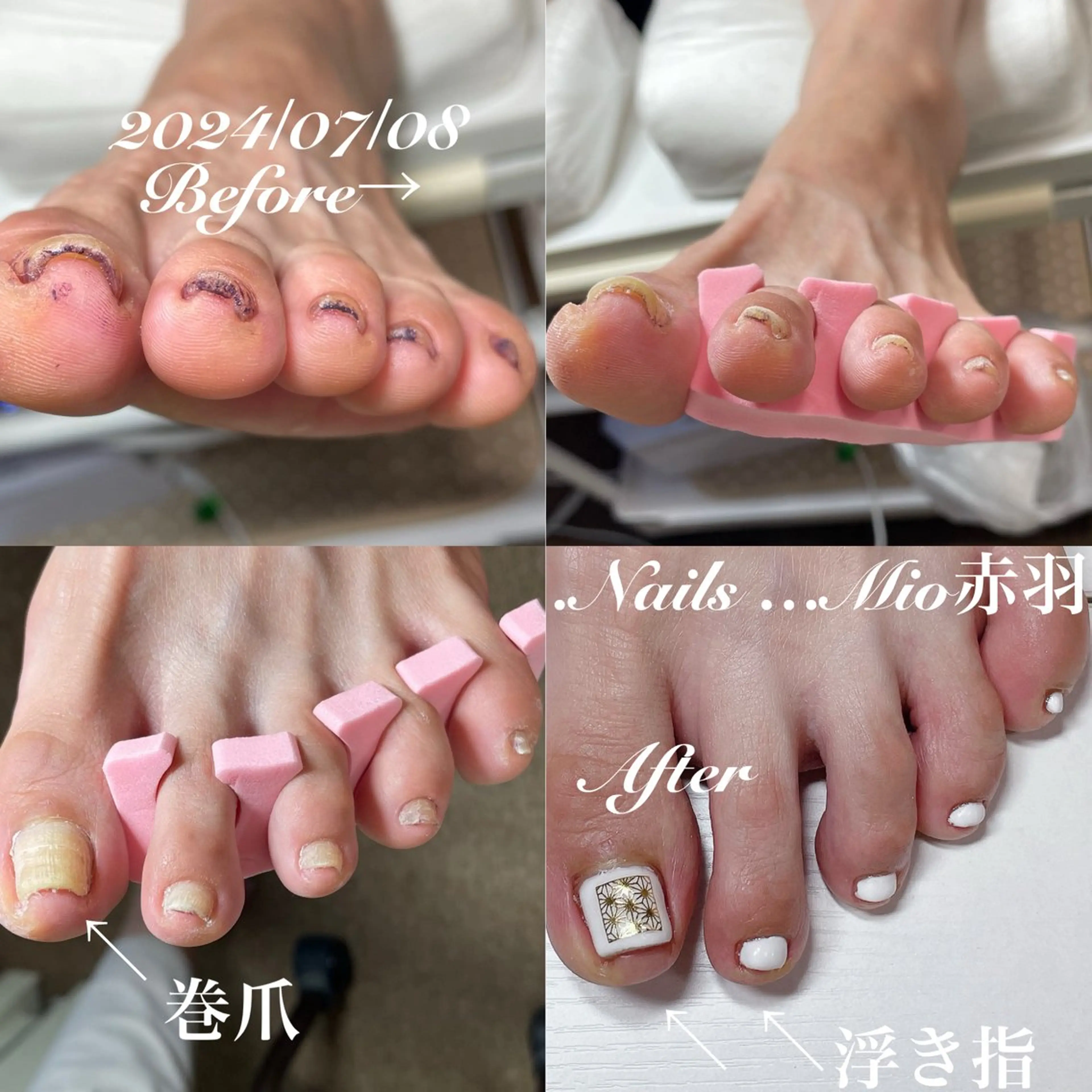ネイル フットネイル .Nails Mio 赤羽西ネイルサロンのネイルデザイン