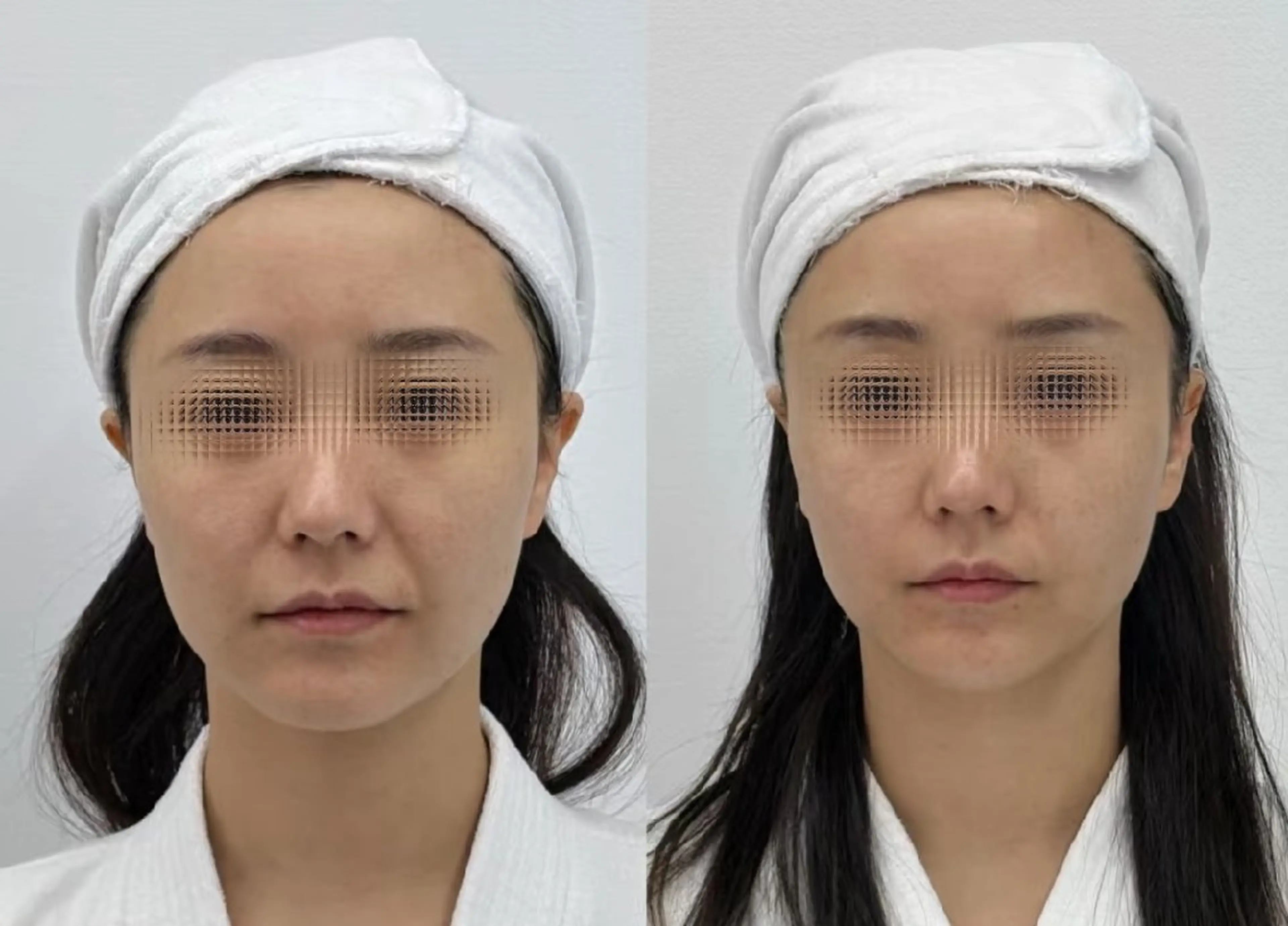 アイブロウ 眉毛ワックス脱毛 aliaハーブ水光店 エステティシャン募集のエステ・リラクイメージ