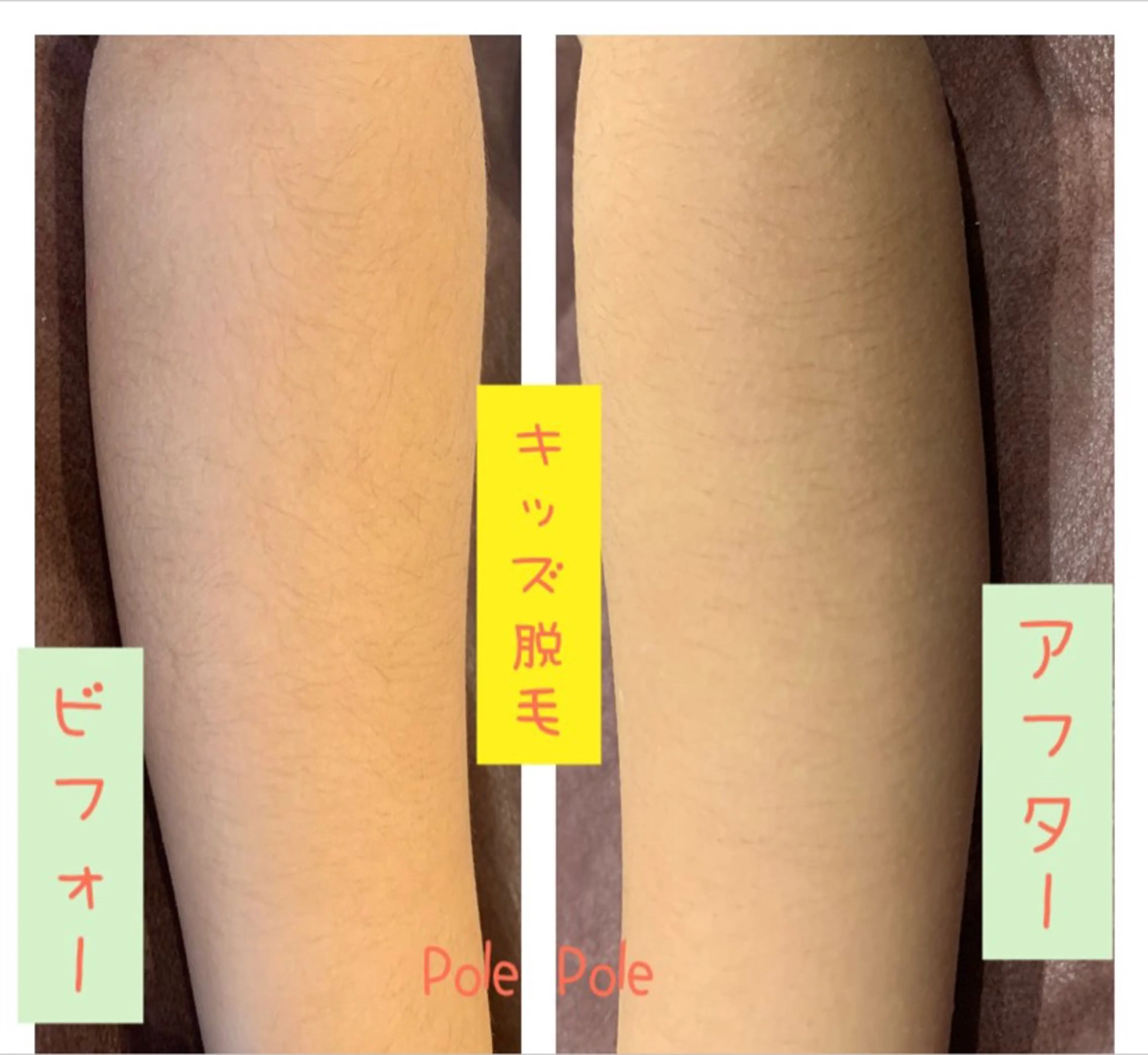 Pole Poleのエステ・リラクイメージ