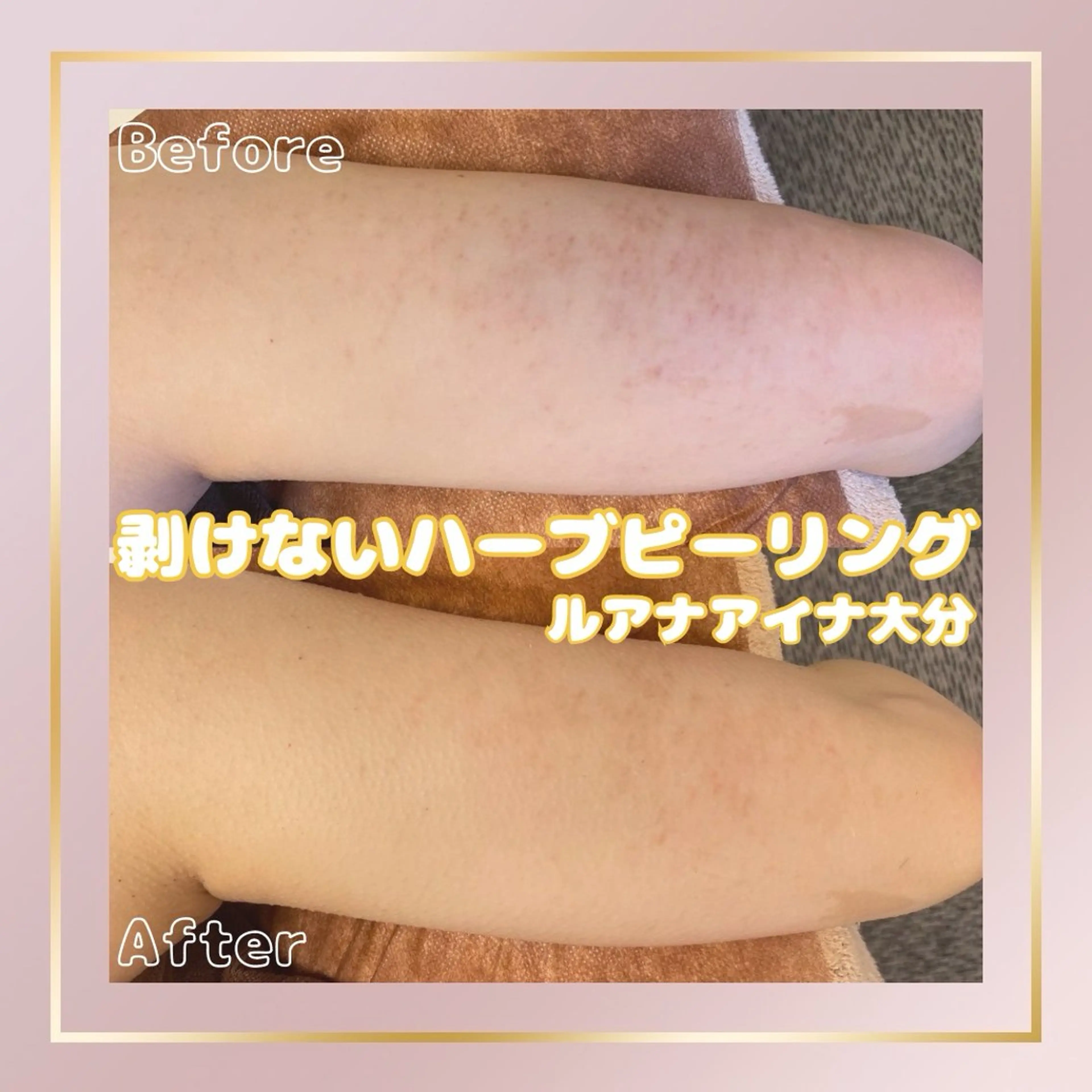 ルアナアイナ 大分のエステ・リラクイメージ