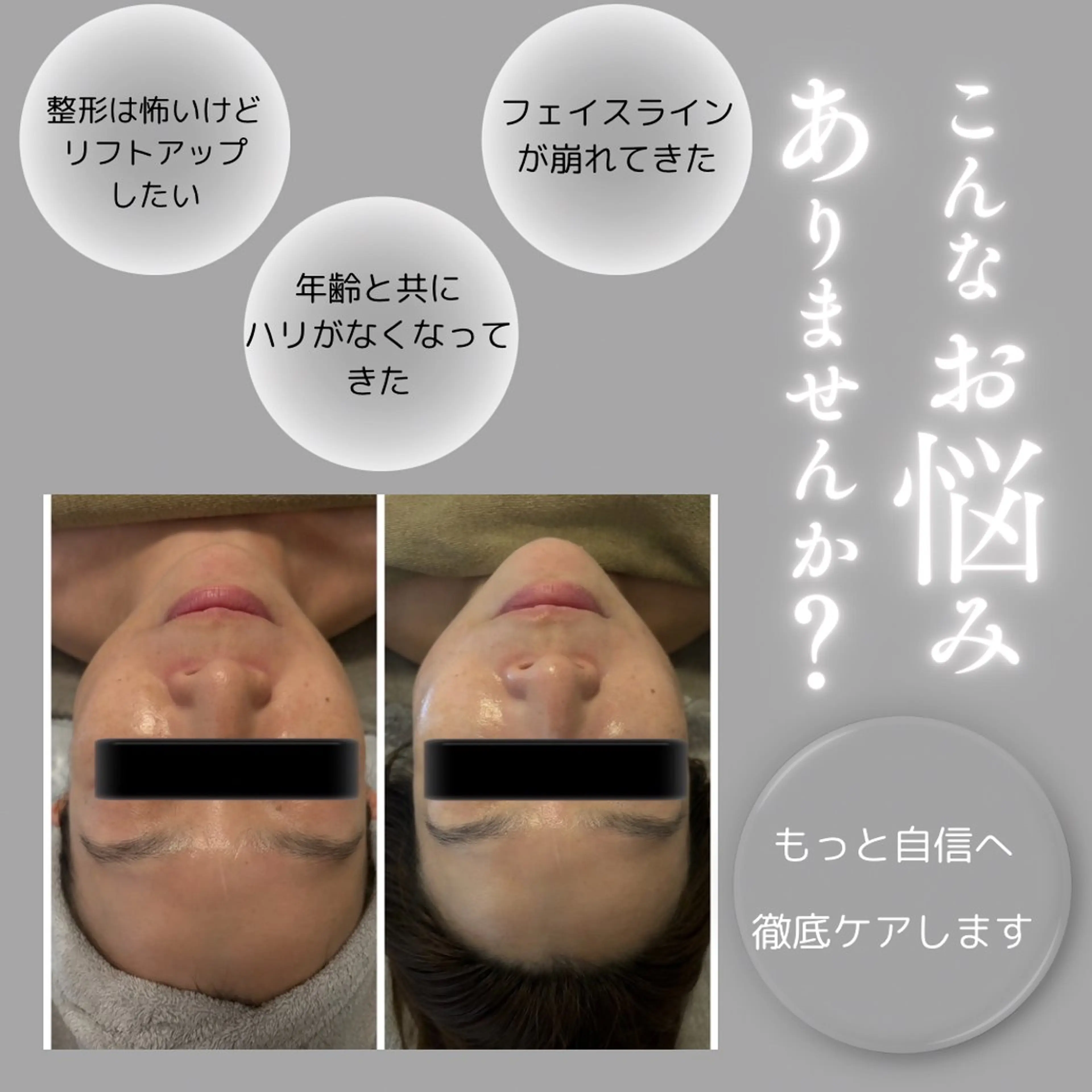 迷ったらこれ!【小顔フェイシャル人気NO1】オーダー120分¥13800→¥8800の写真