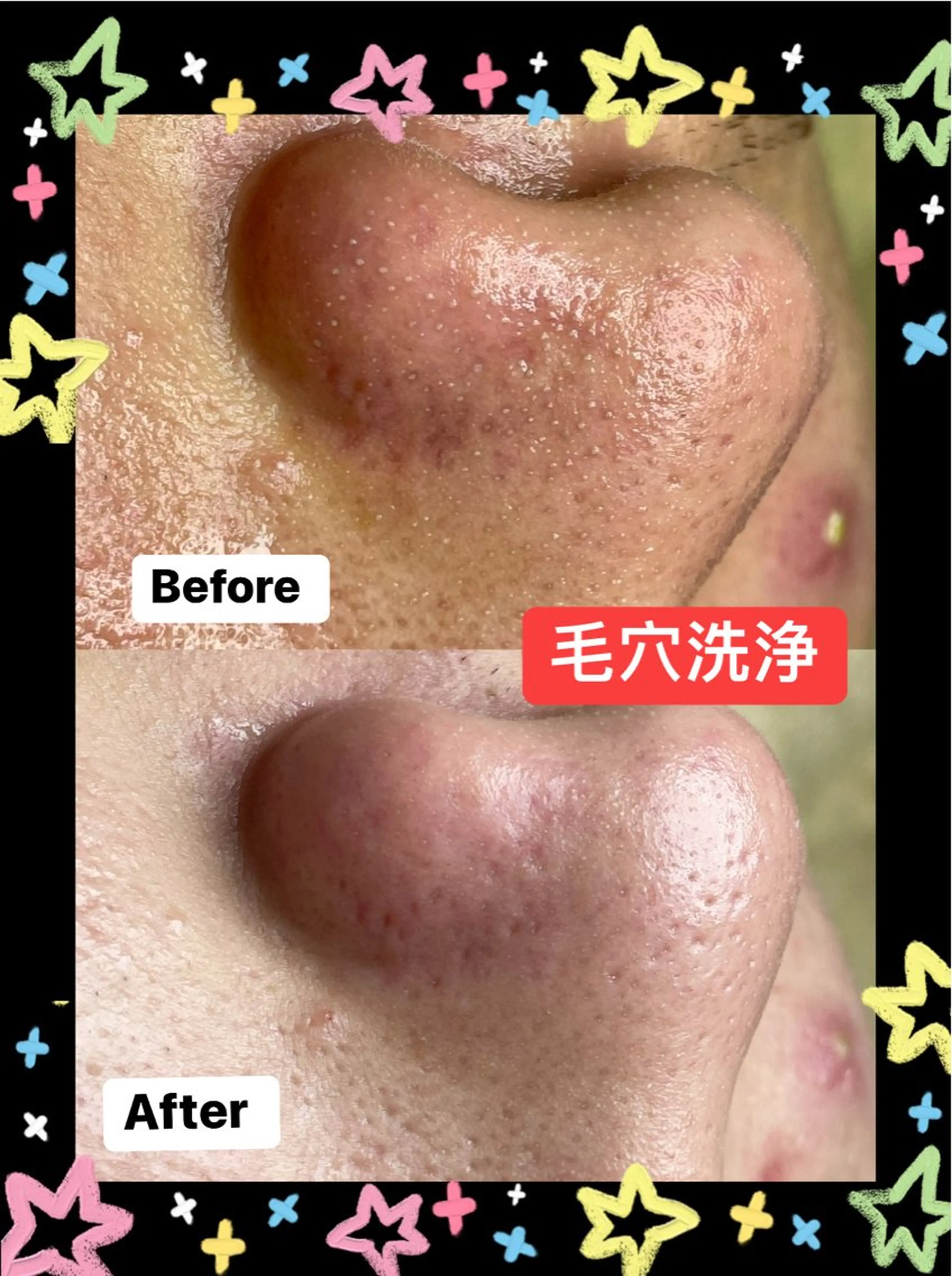 美肌，美ボディ，脱毛 サクラチャンスパのエステ・リラクイメージ