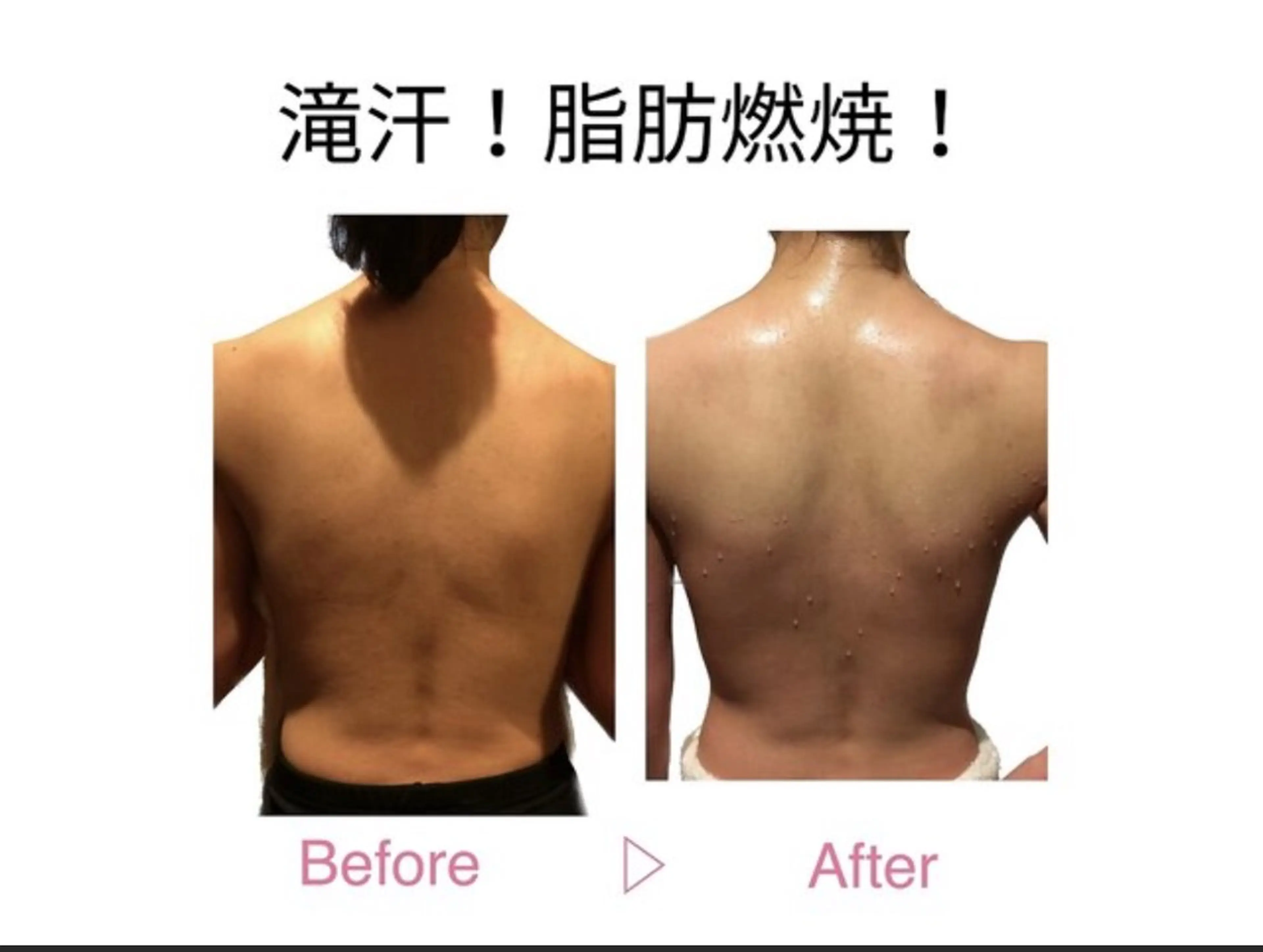 神痩せ!本気度No,1.痩身、小顔、美肌の近道♪結果重視コース 13800→7800円の写真