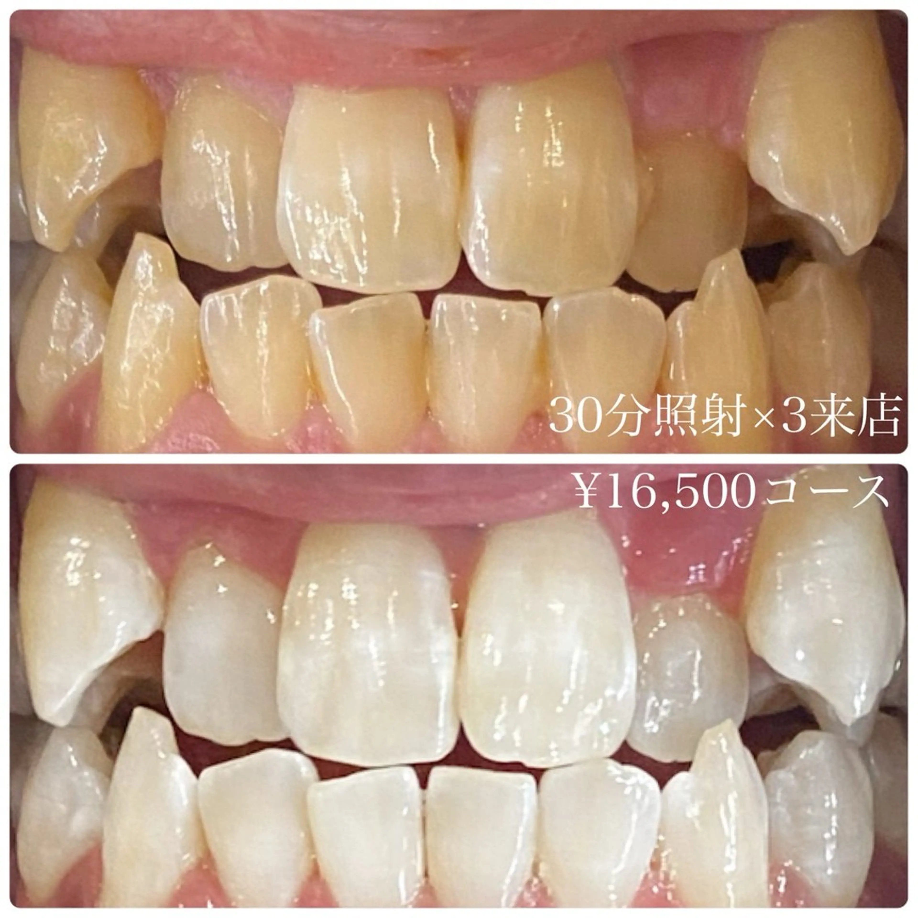 その他 PLATINUM Beauty 横浜店所属・ホワイトニングルーム 横浜店のその他イメージ