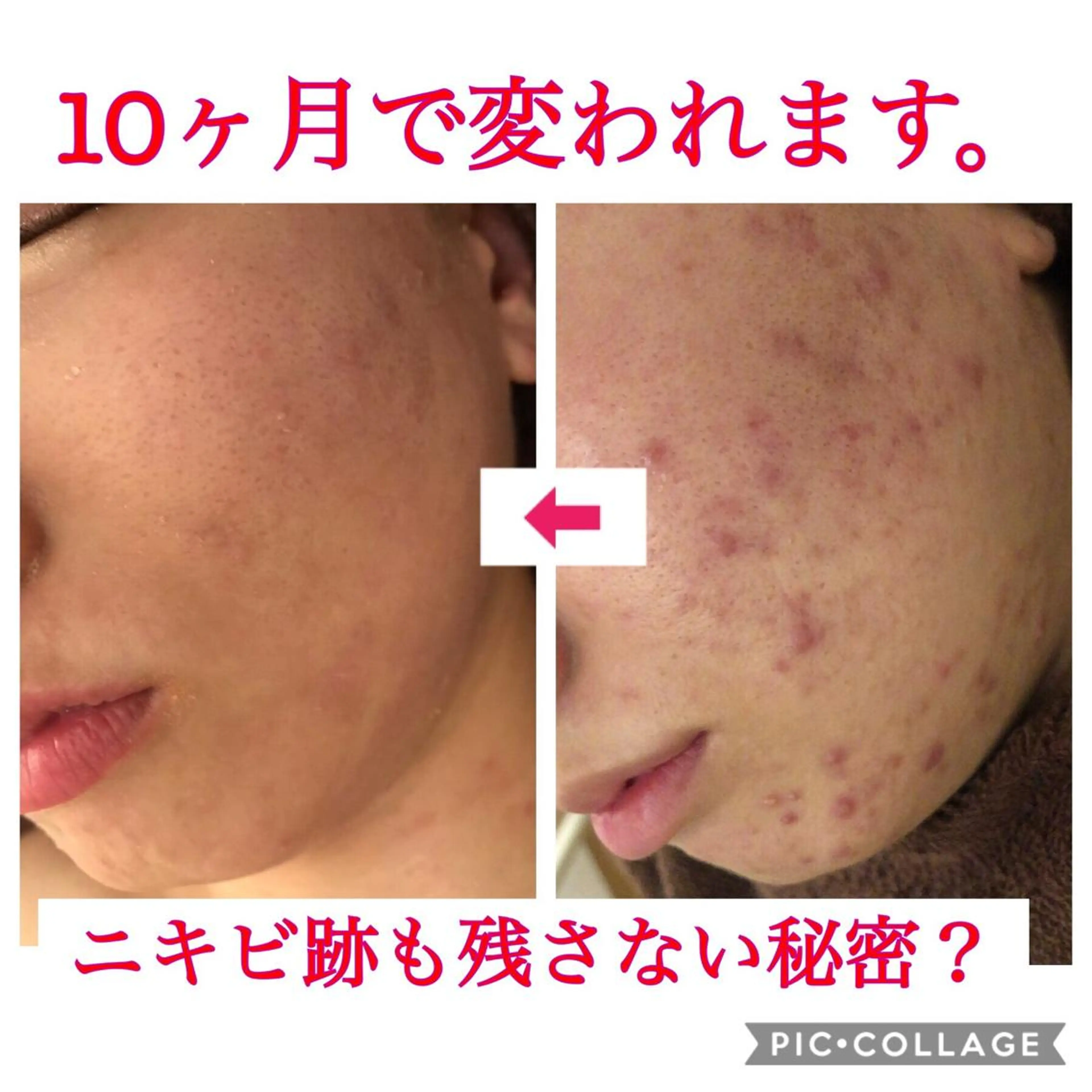 セミロング カラー パーマ ヘアアレンジ メンズ キッズ ネイル マツエク・マツパ 金の糸脱毛 産毛ケア専門のエステ・リラクイメージ