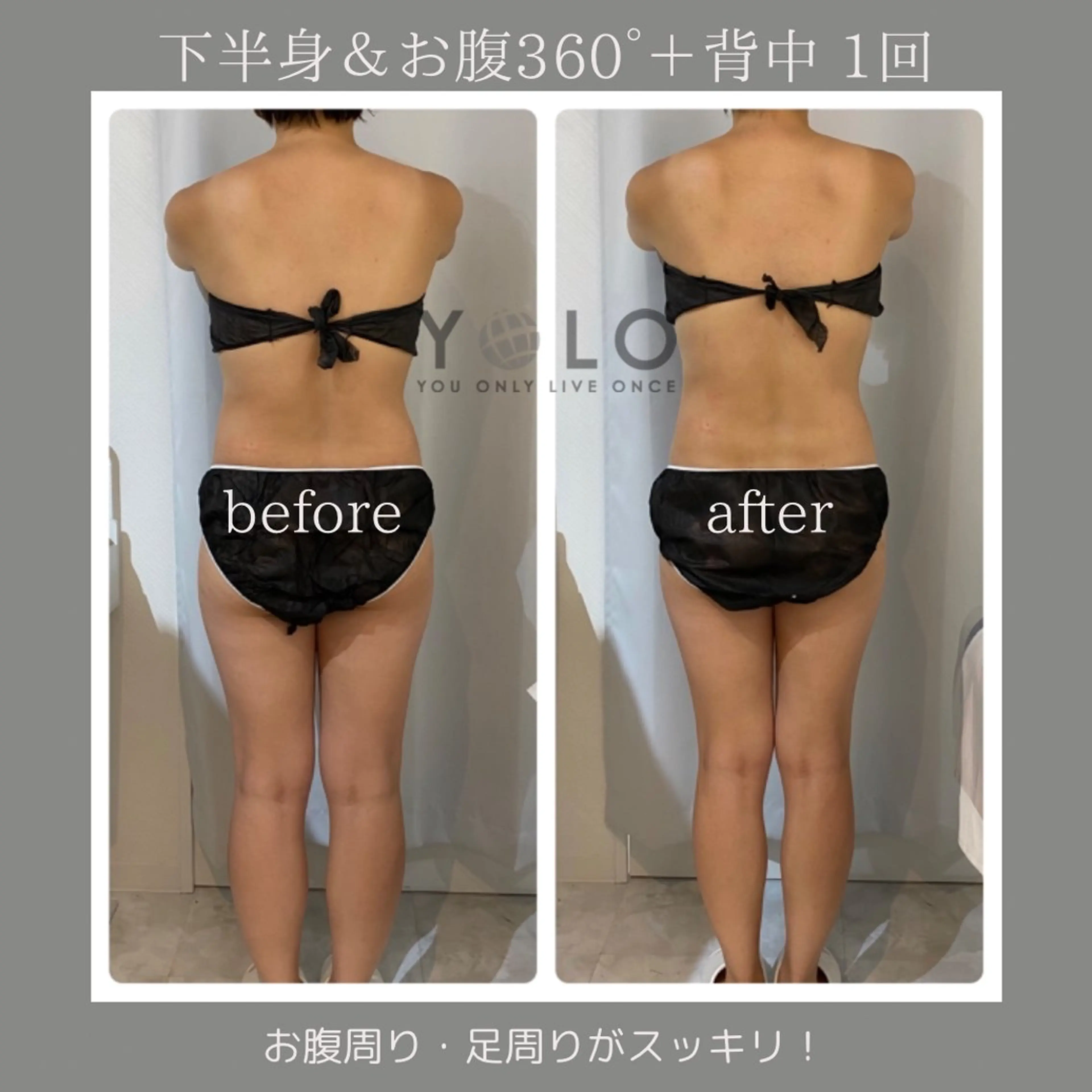 【モニター様 3名募集】筋膜リリース⭐️痩身エステ(上半身or下半身) 60分×4回の写真