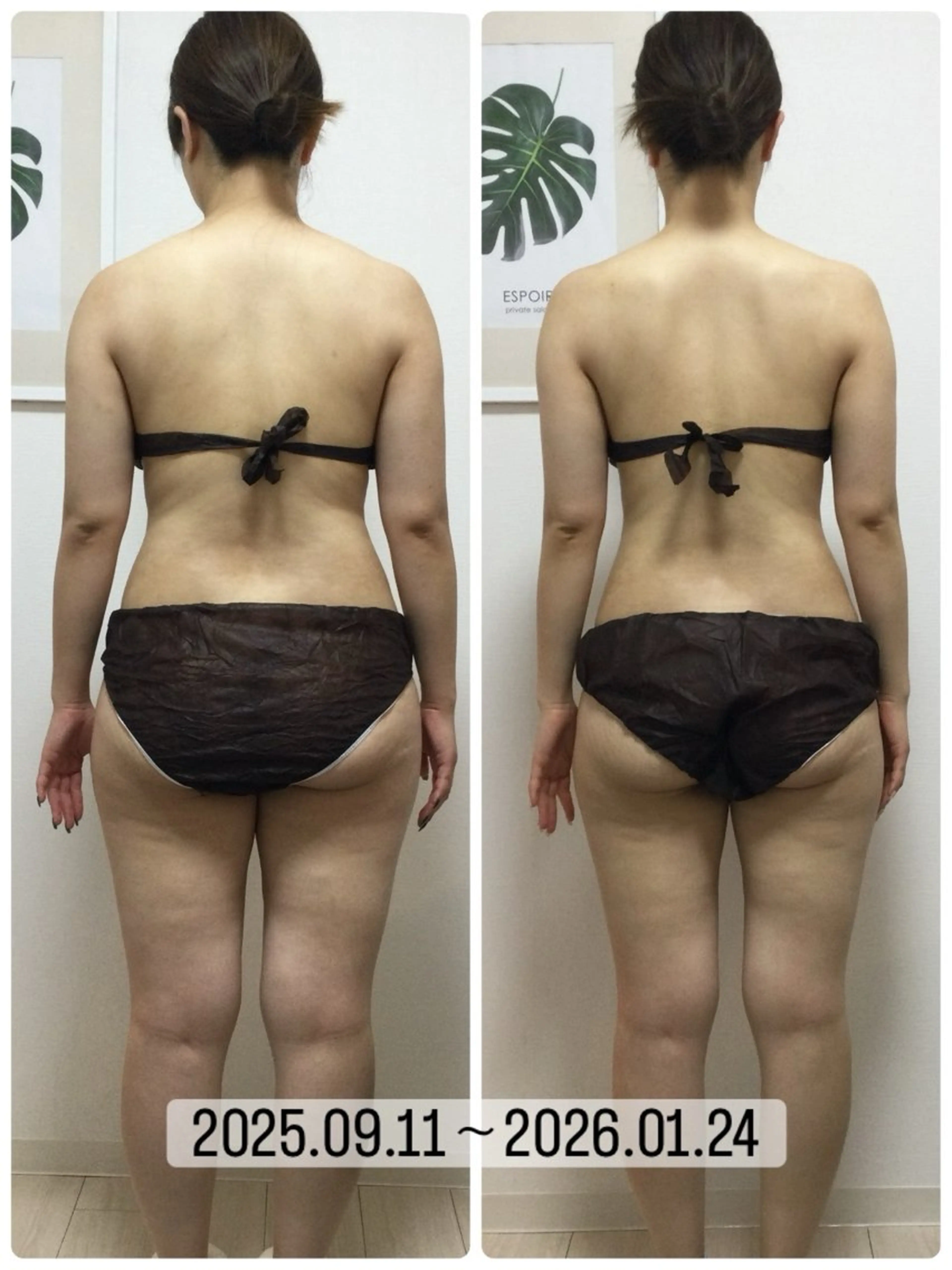 エステ リラク ESPOIR エスポワールのエステ・リラクイメージ