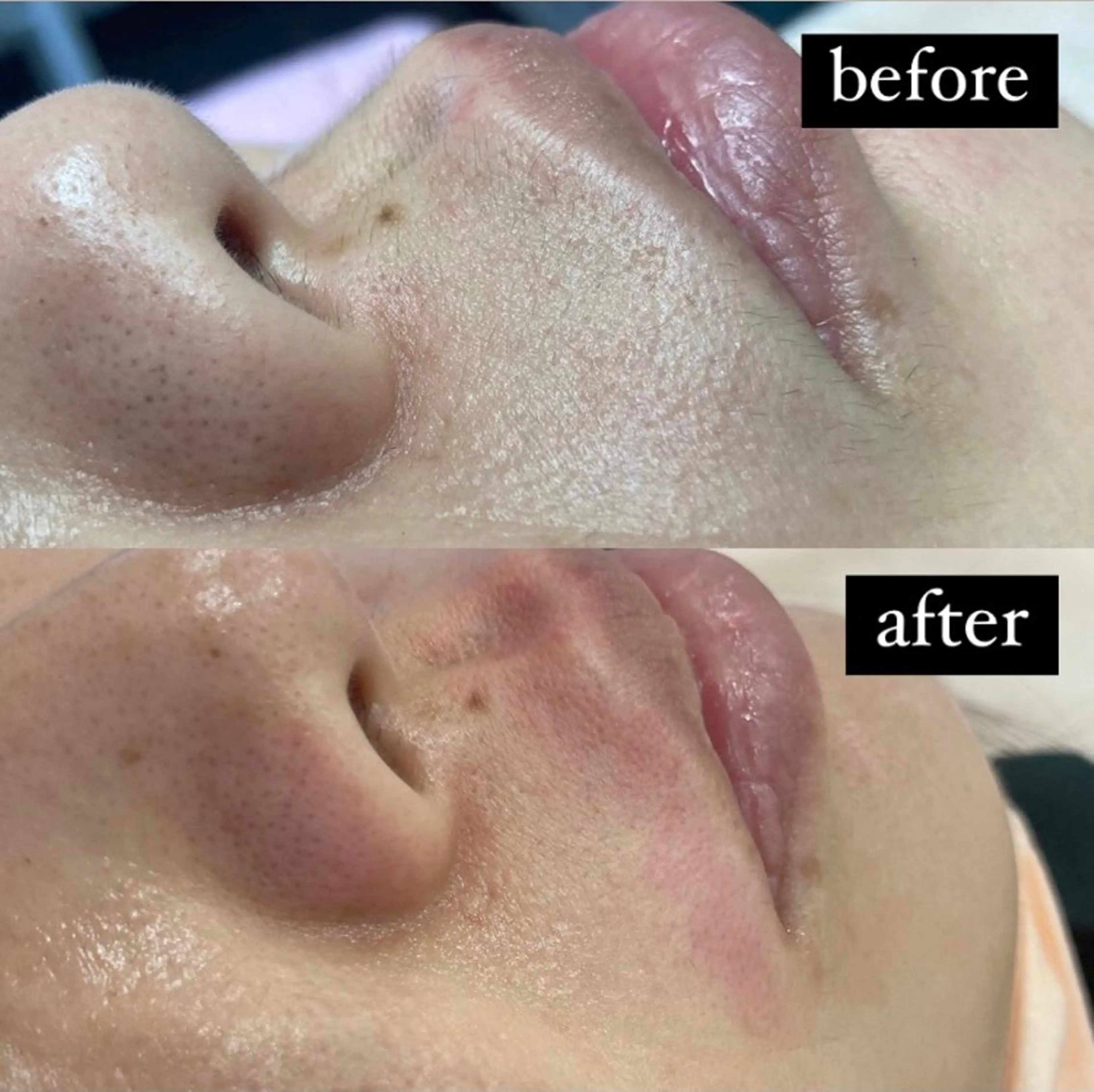 アイブロウ 眉毛ワックス脱毛 ‎🤍nabi 代官山/渋谷/恵比寿のマツエク・マツパデザイン