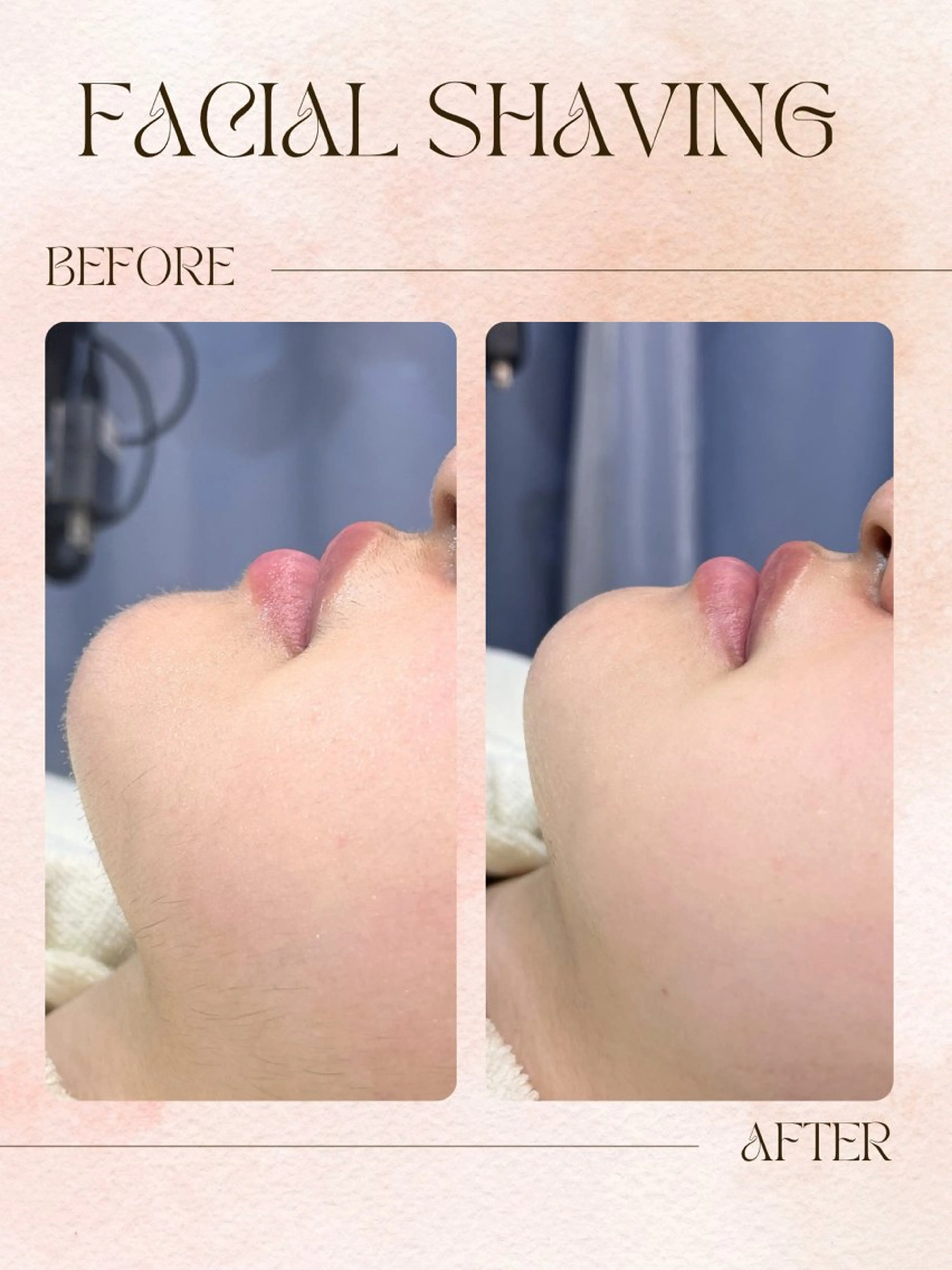 【🌷顔シェービング撮影モデル🌷】眉毛も可！カウンセリングなし！の写真