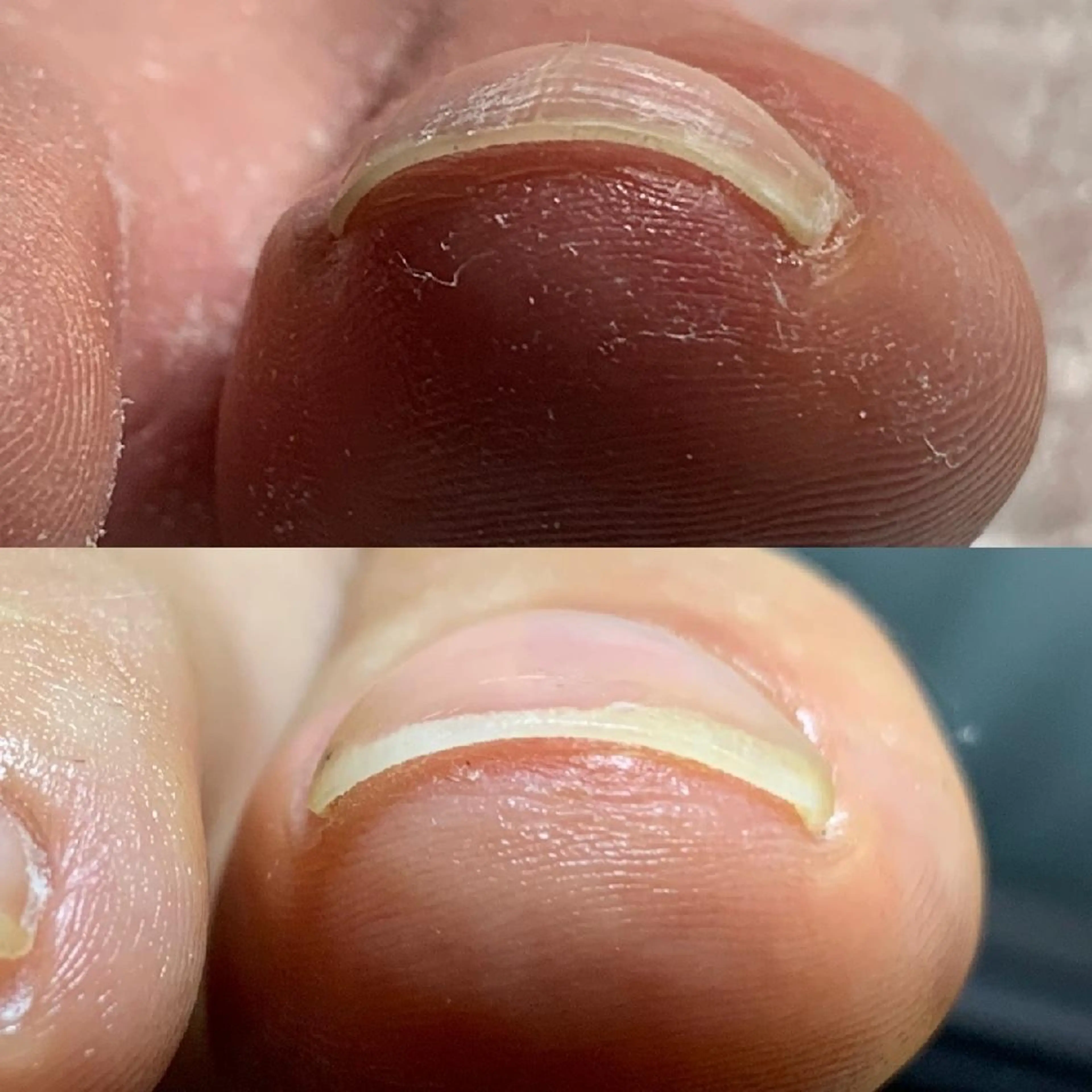 その他 carenail　 tsugumiのその他イメージ