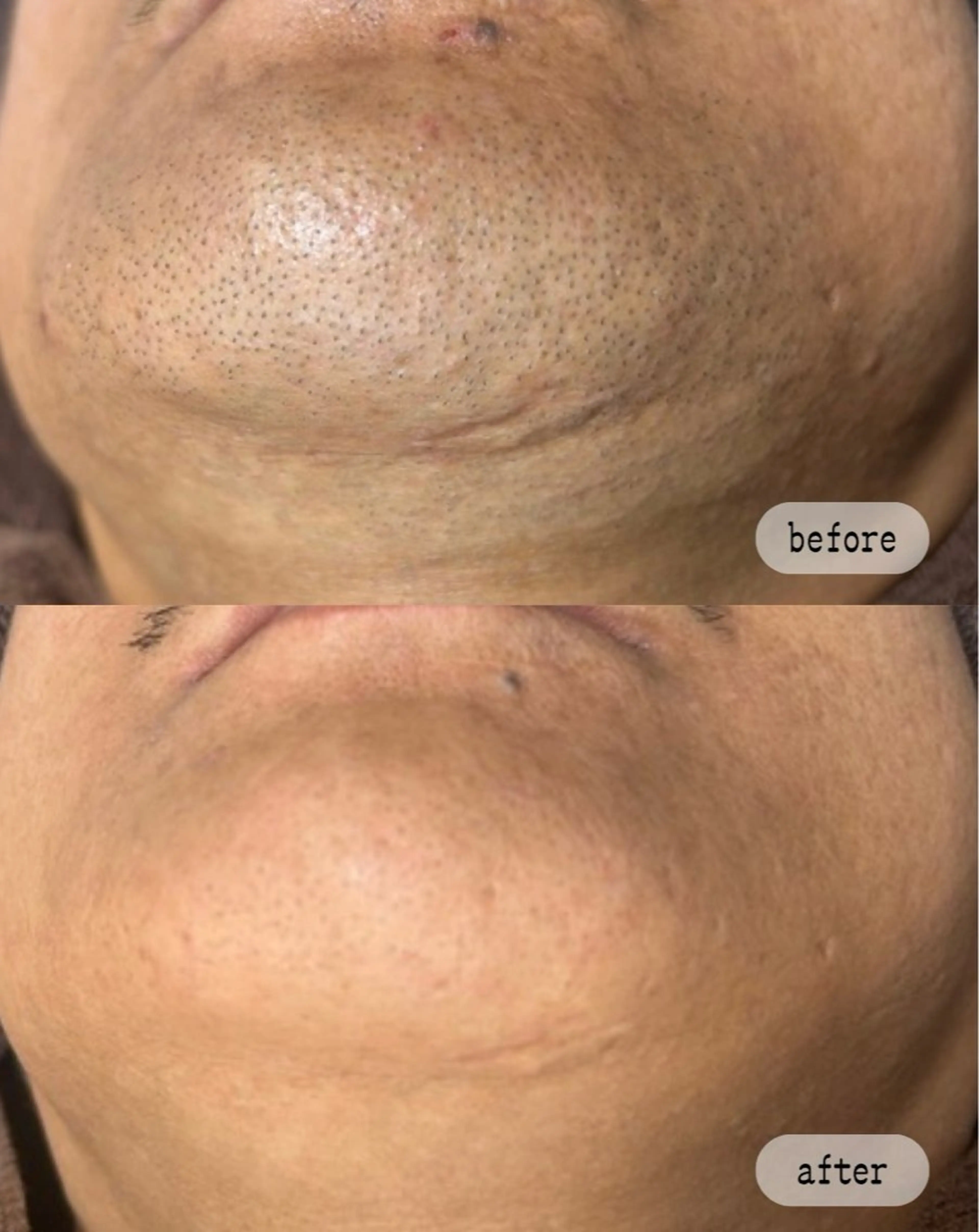 脱毛 LaVibe ann.のエステ・リラクイメージ