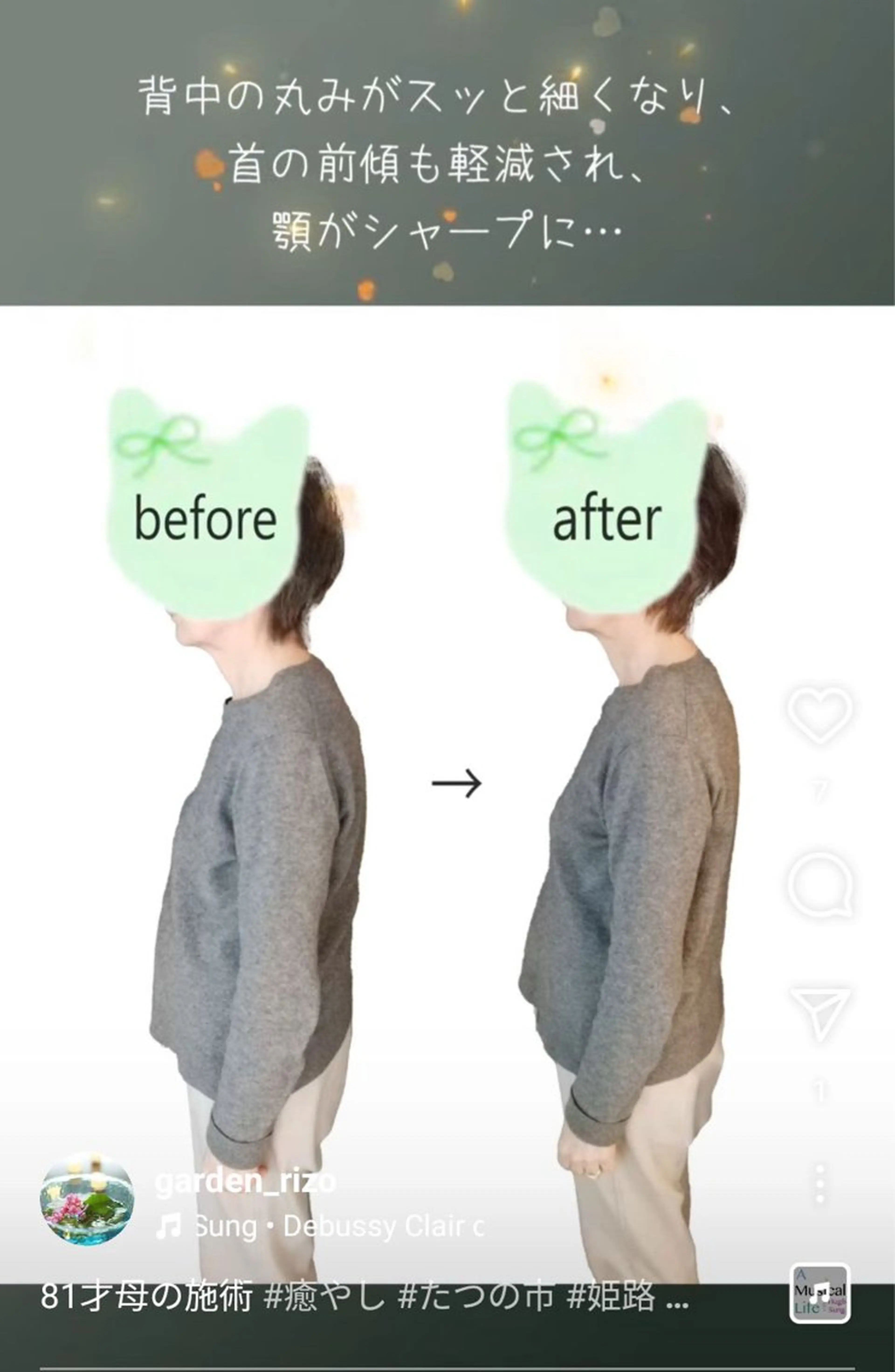 リラク オイルトリートメント GardenRizoのエステ・リラクイメージ