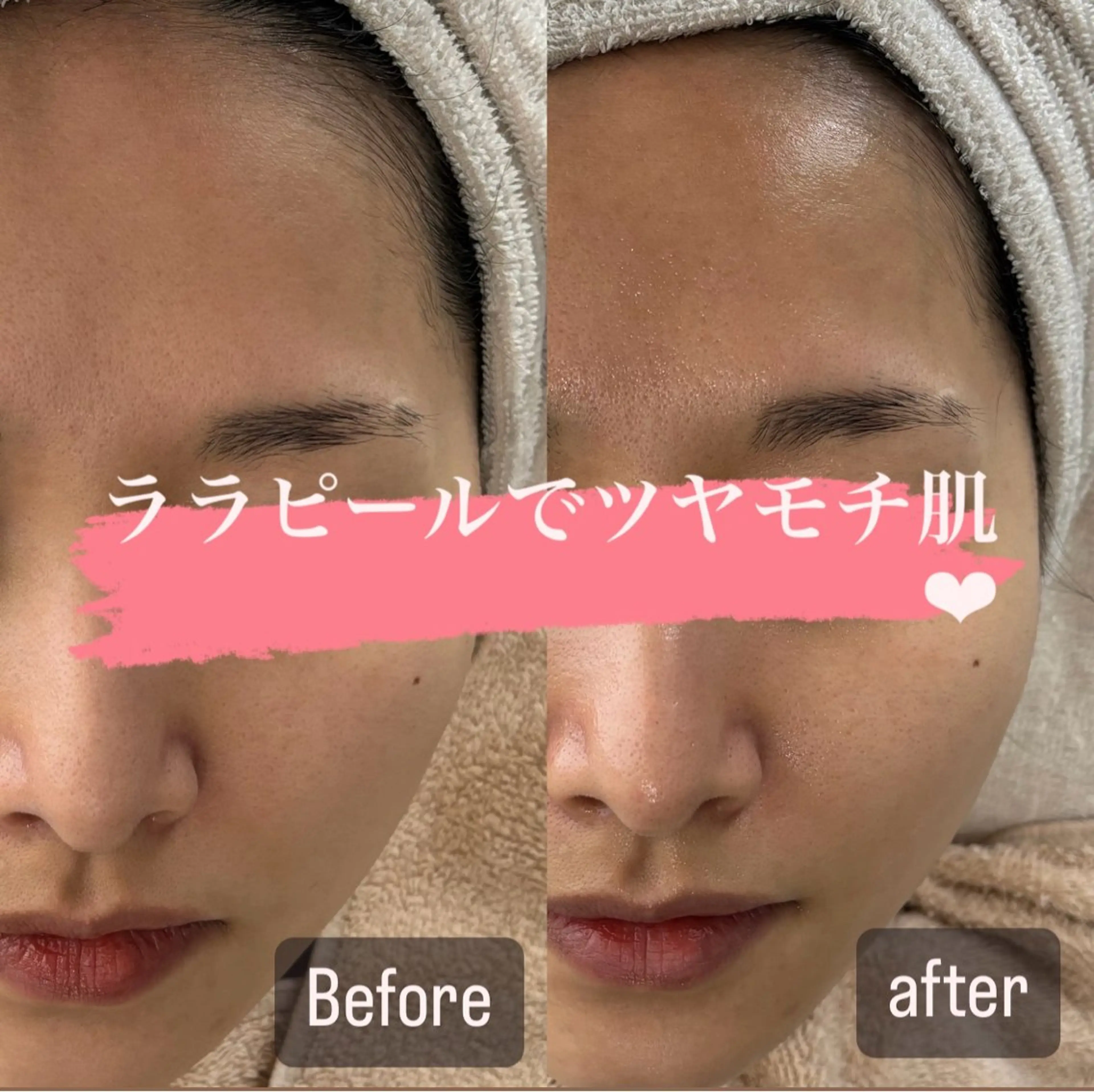 mili mili beauty salon所属・mili mili 岡本のエステ・リラクイメージ