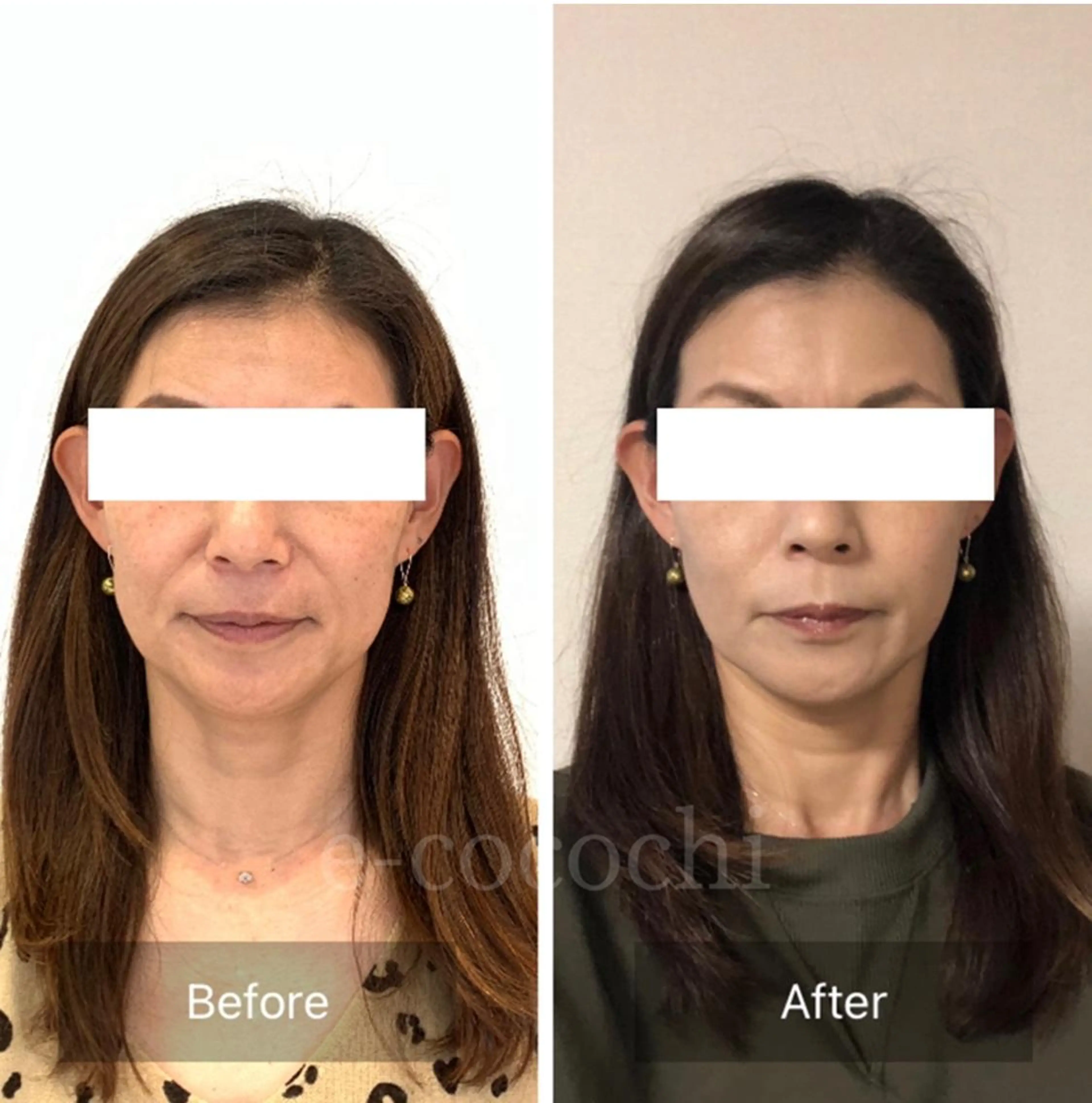 エステ リラク 小顔と ヘッドスパのお店のエステ・リラクイメージ