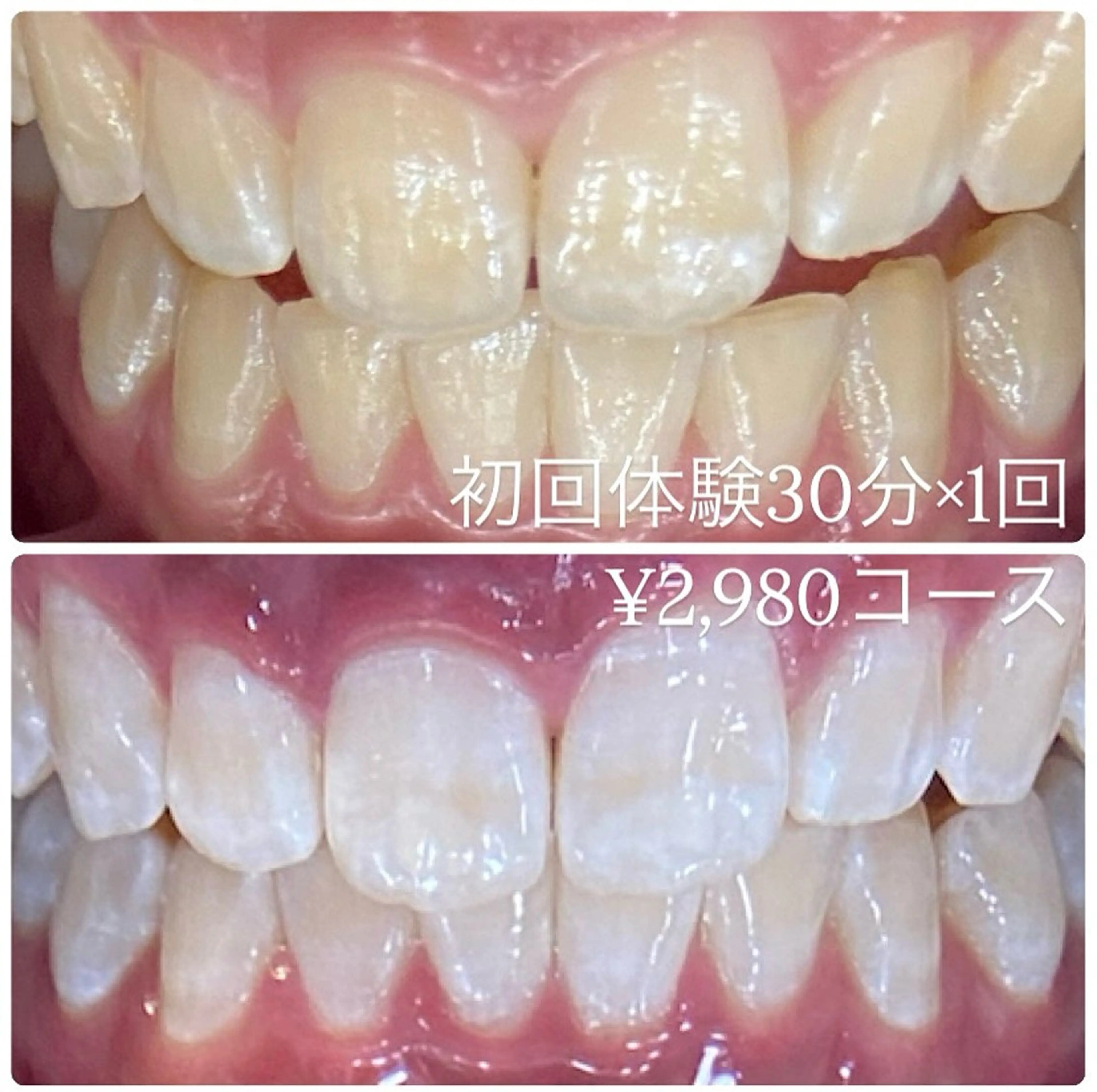 PLATINUM Beauty 横浜店所属・ホワイトニングルーム 横浜店のその他イメージ