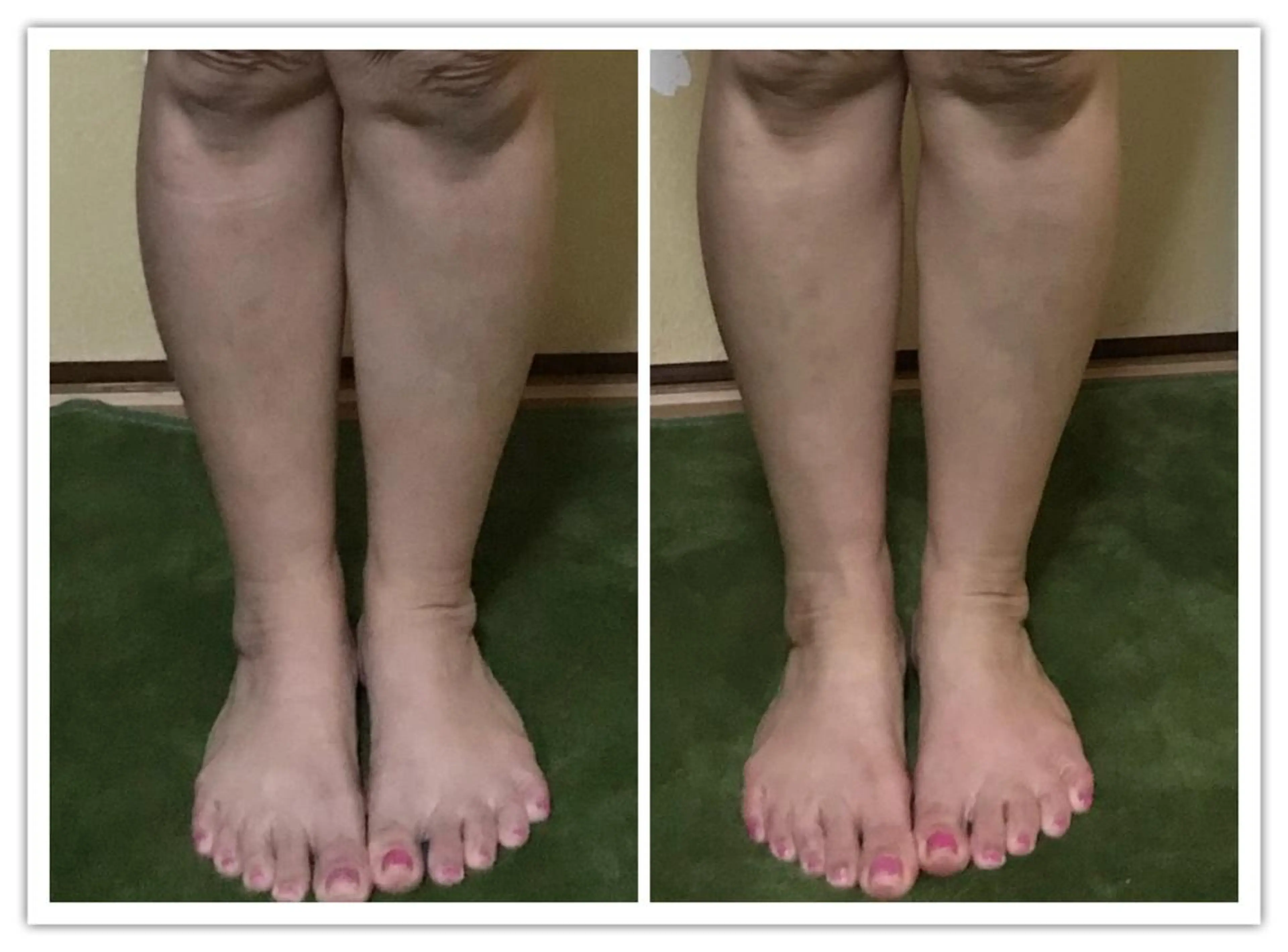 【足圧】鬼👹リンパ 身体整うサロンのエステ・リラクイメージ