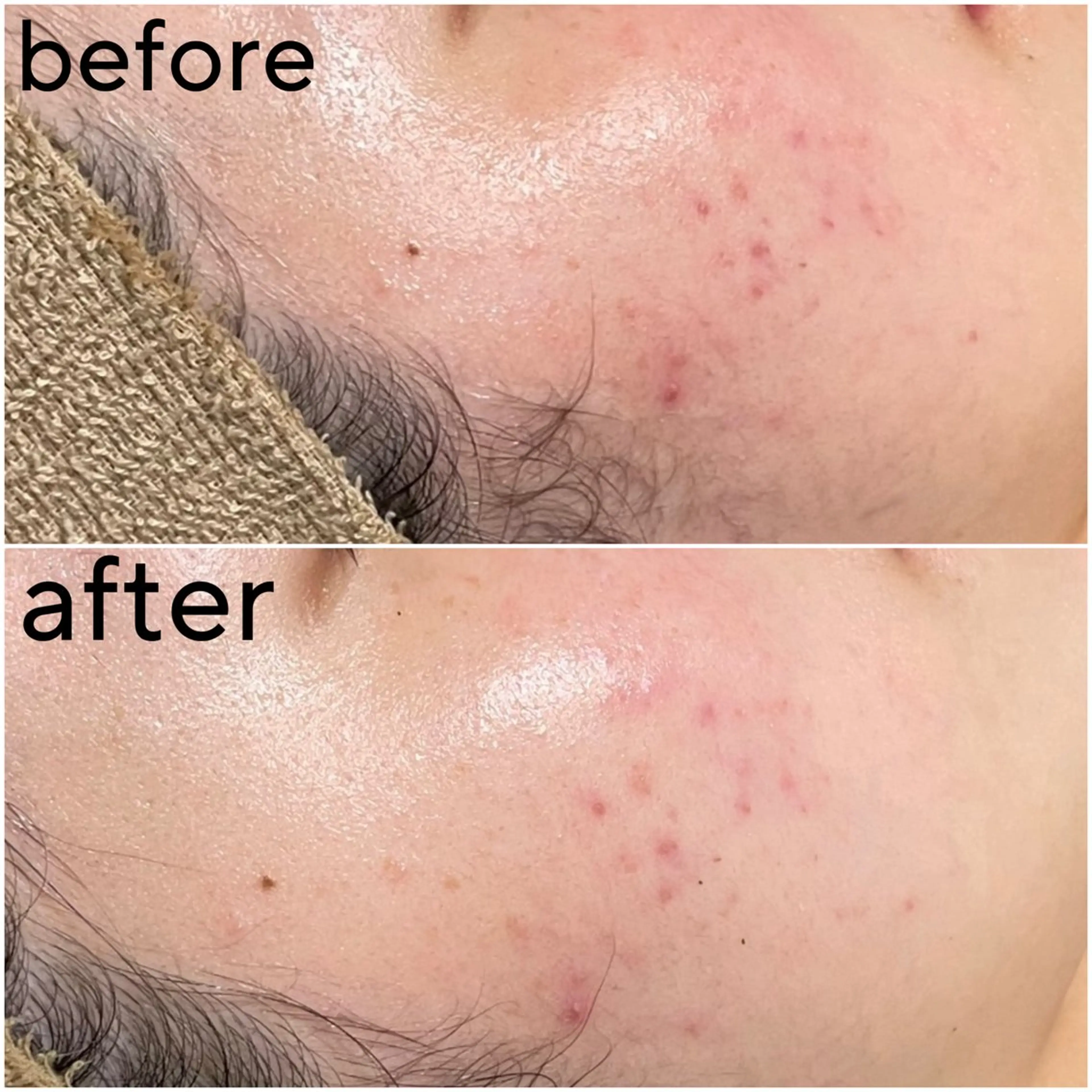 エステ amber(アンバー)所属・プライベートサロン amberのエステ・リラクイメージ