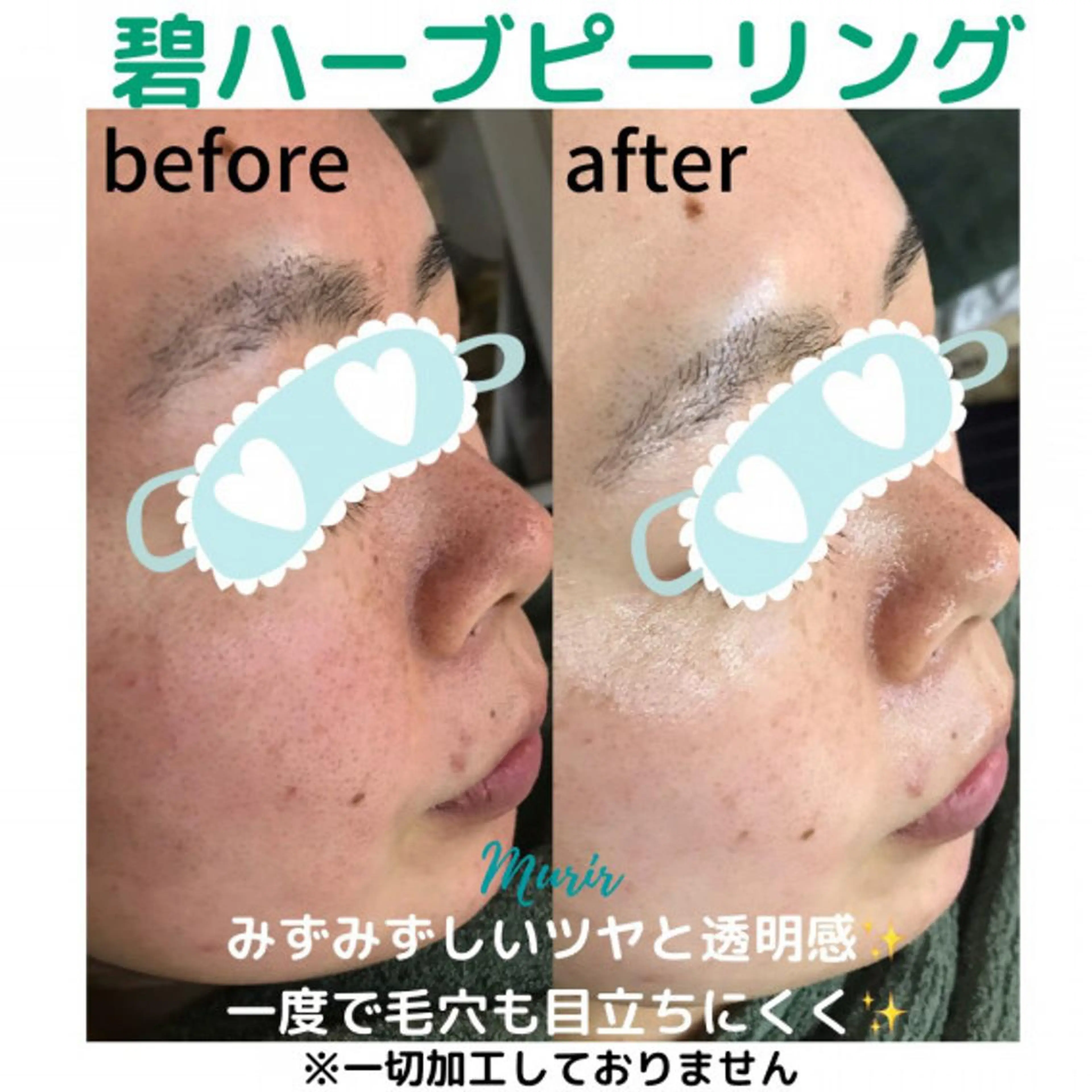 肌質体質改善サロン ミュリール 橋本店のエステ・リラクイメージ