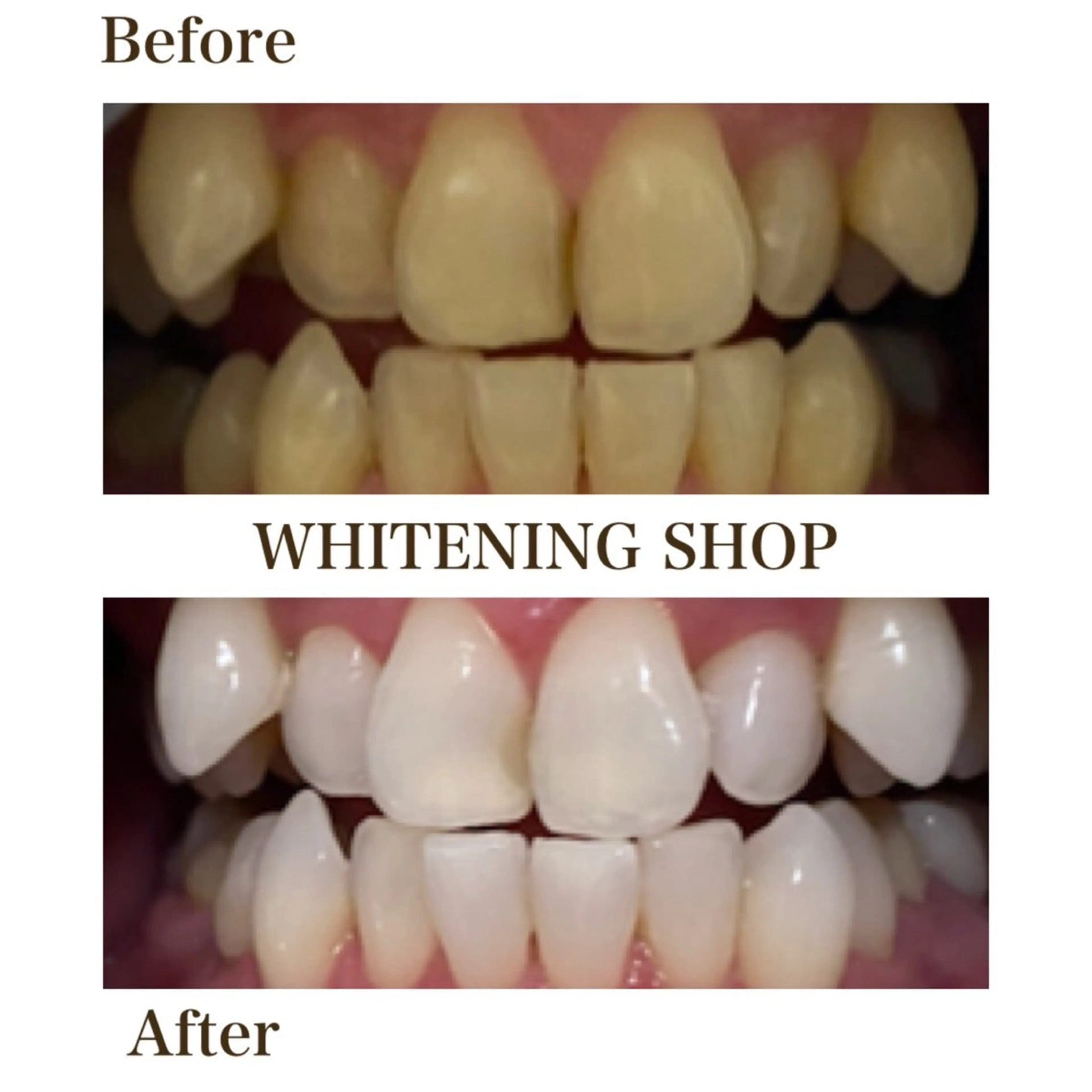 エステ リラク ホワイトニング ショップ川越店のエステ・リラクイメージ