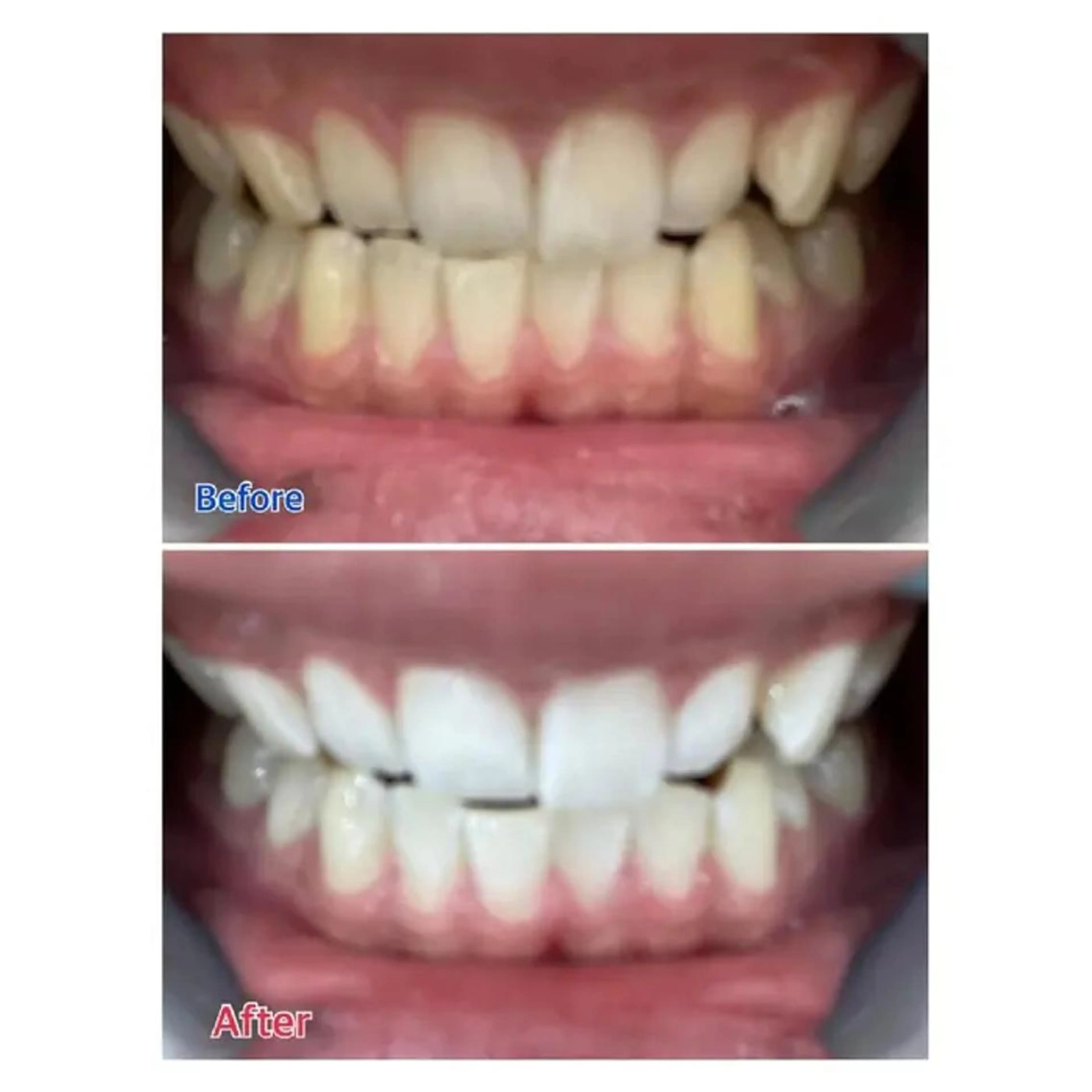 M渋谷 ホワイトニングのエステ・リラクイメージ