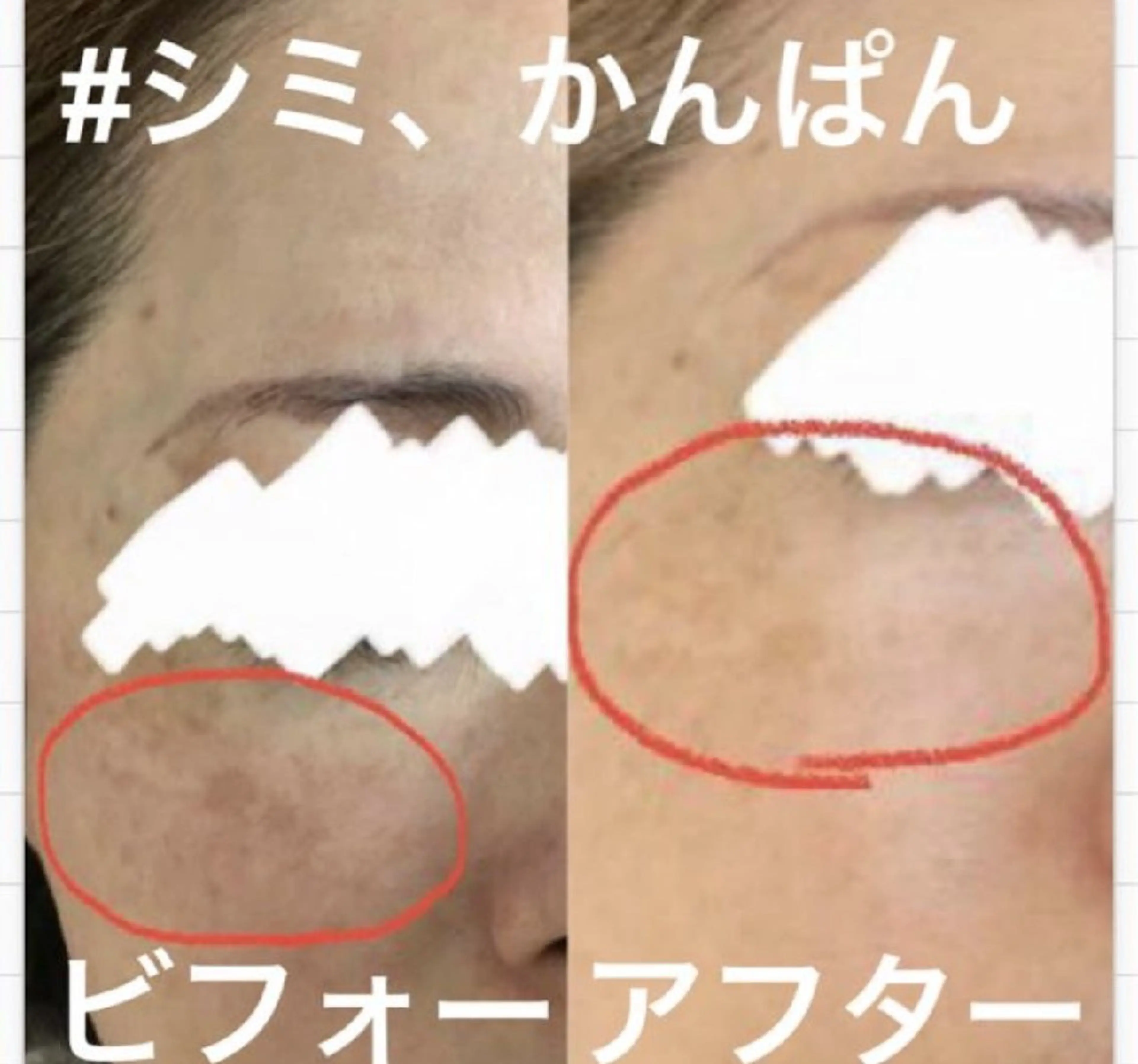 エステ ハーブピーリング専門 COCO.梅田中津のエステ・リラクイメージ