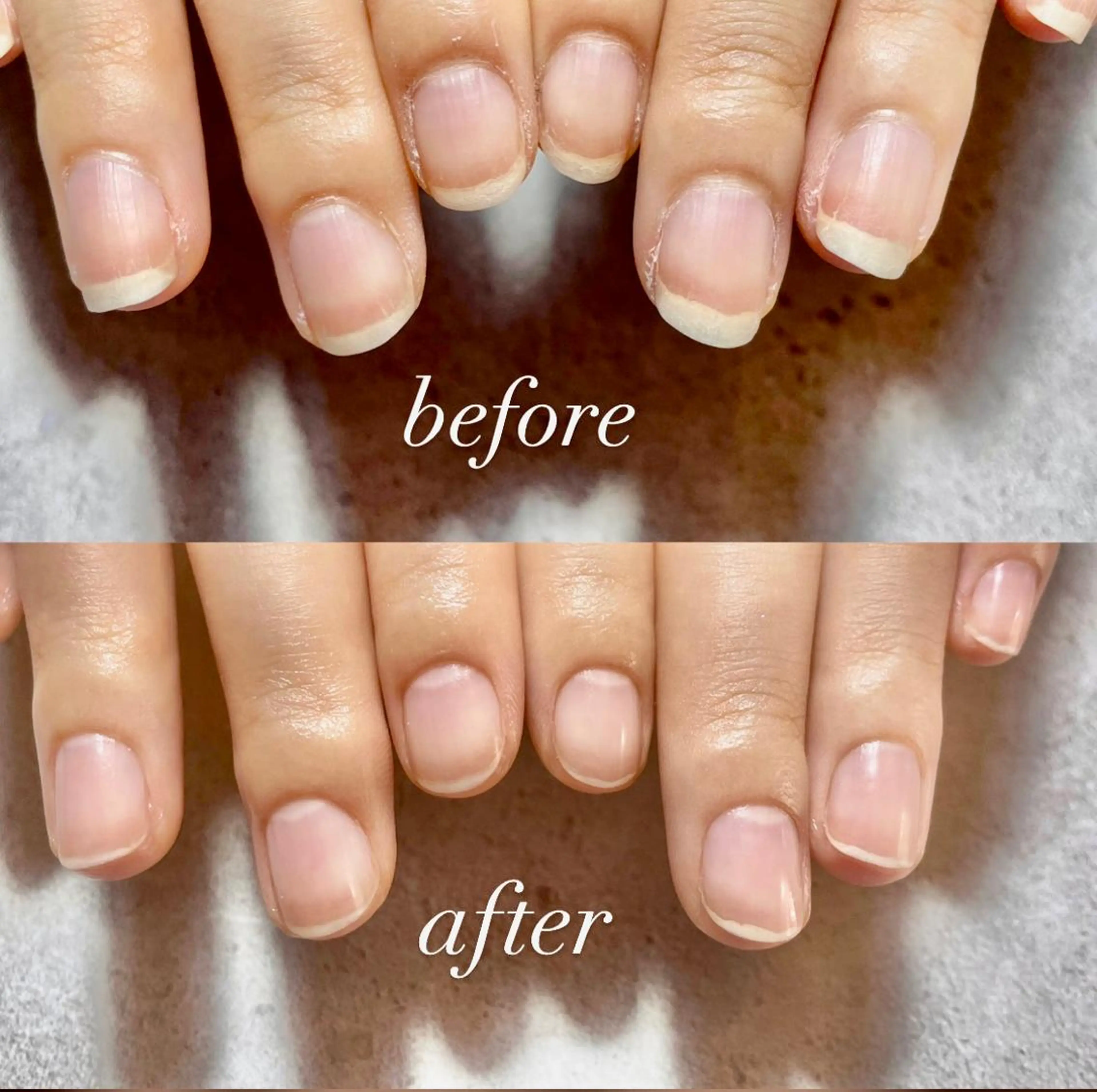 🌿自爪派さんへ【スペシャルネイルケア】の写真