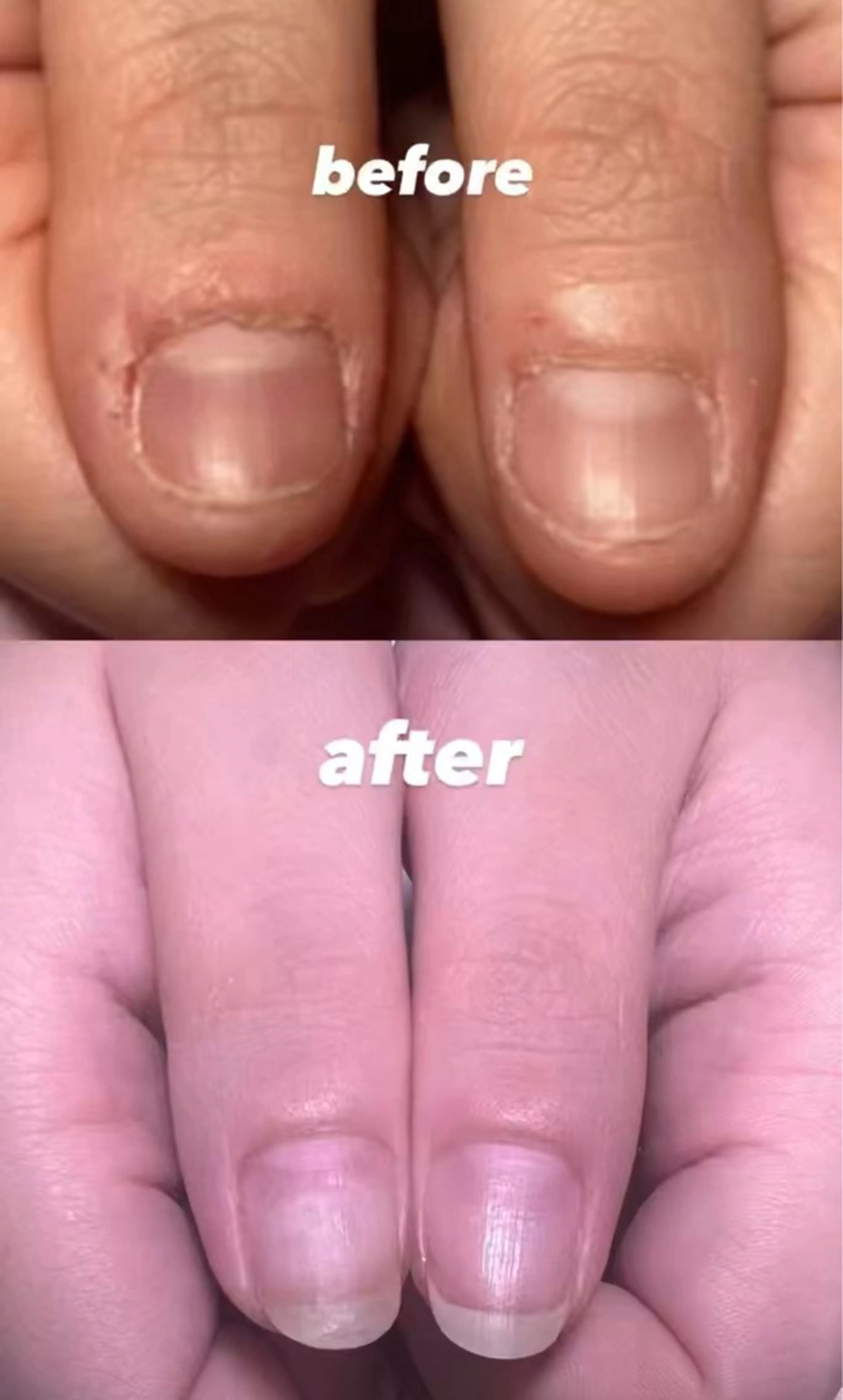 メンズ ネイル ハンドネイル 爪ケア/深爪 自爪育成 🐰えむのネイルデザイン