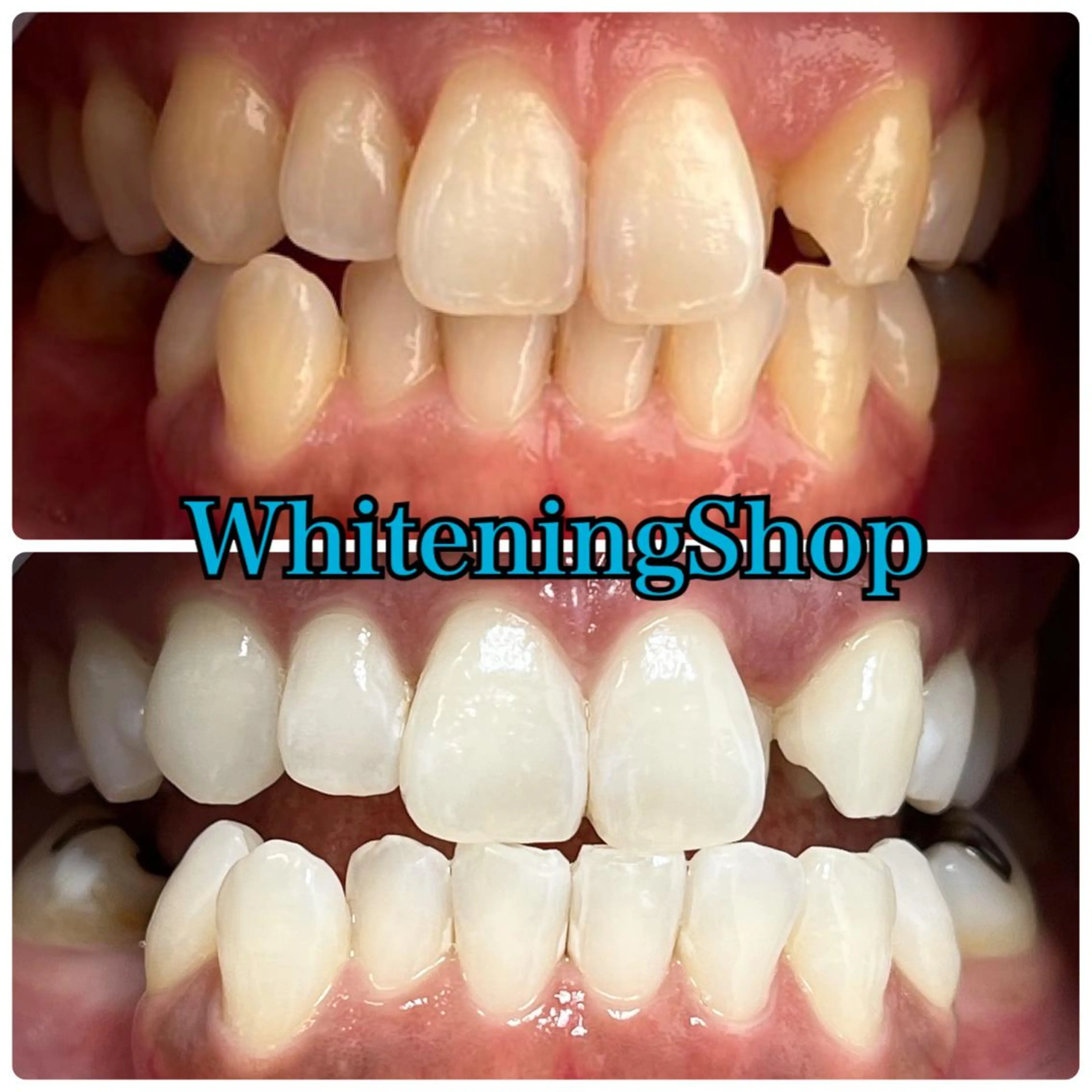 ホワイトニング ショップ吉祥寺店のエステ・リラクイメージ