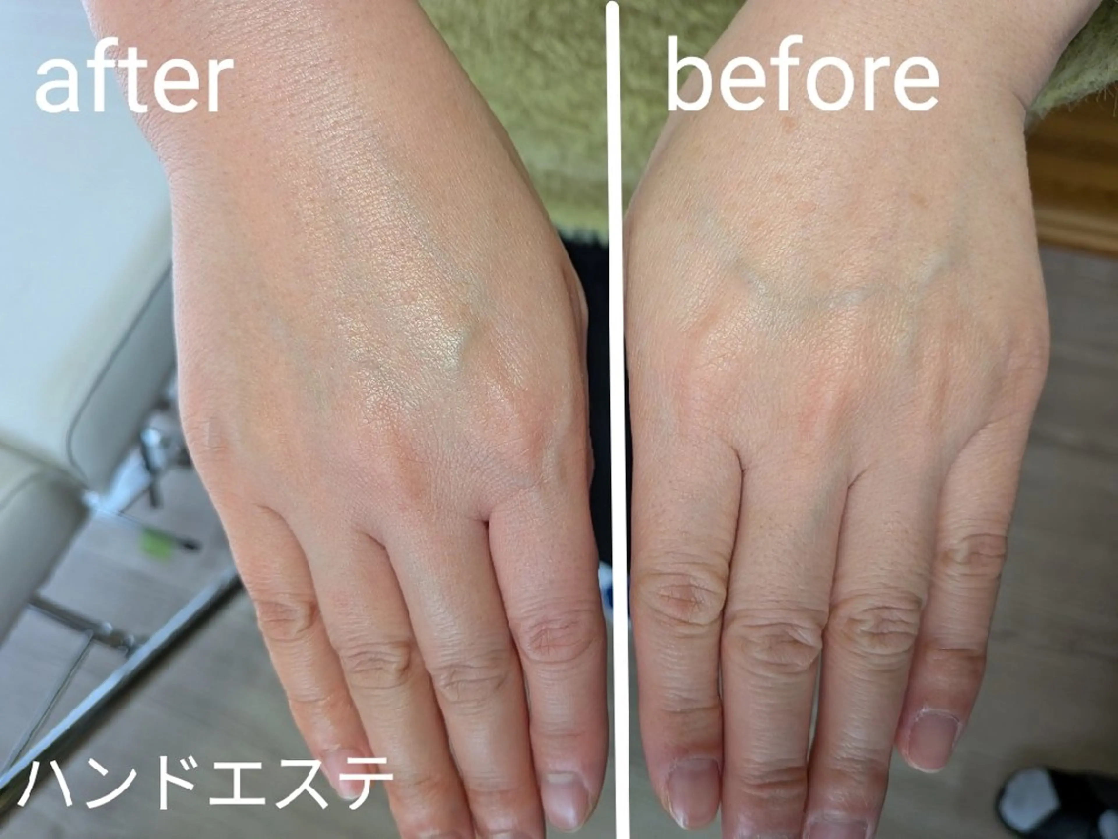 【手元ふっくら】極上ハンドエステ✨パラフィンパック付の写真