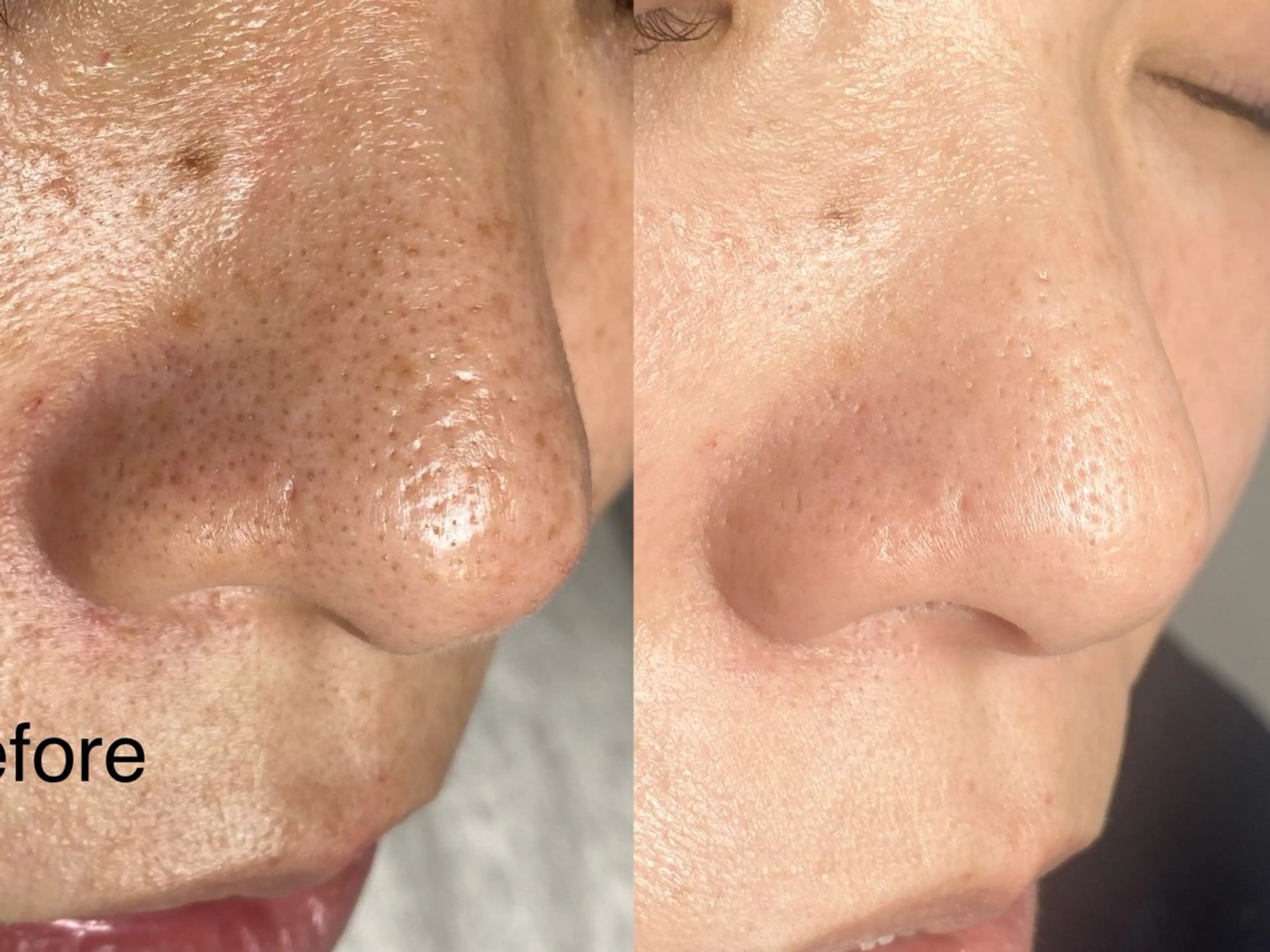 mone (モーネ)のエステ・リラクイメージ