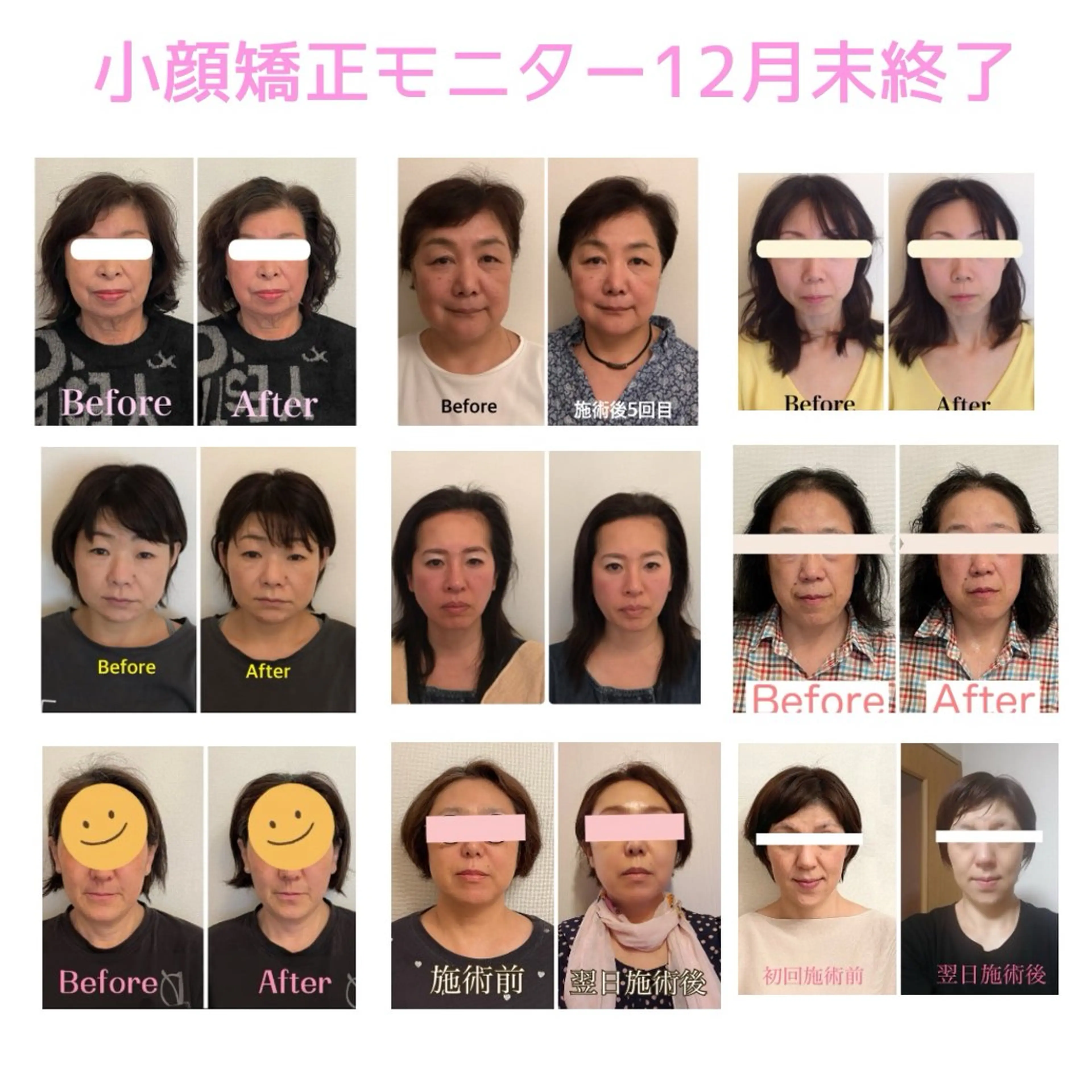 町田・鶴川 小顔矯正 /鈴木友実のエステ・リラクイメージ