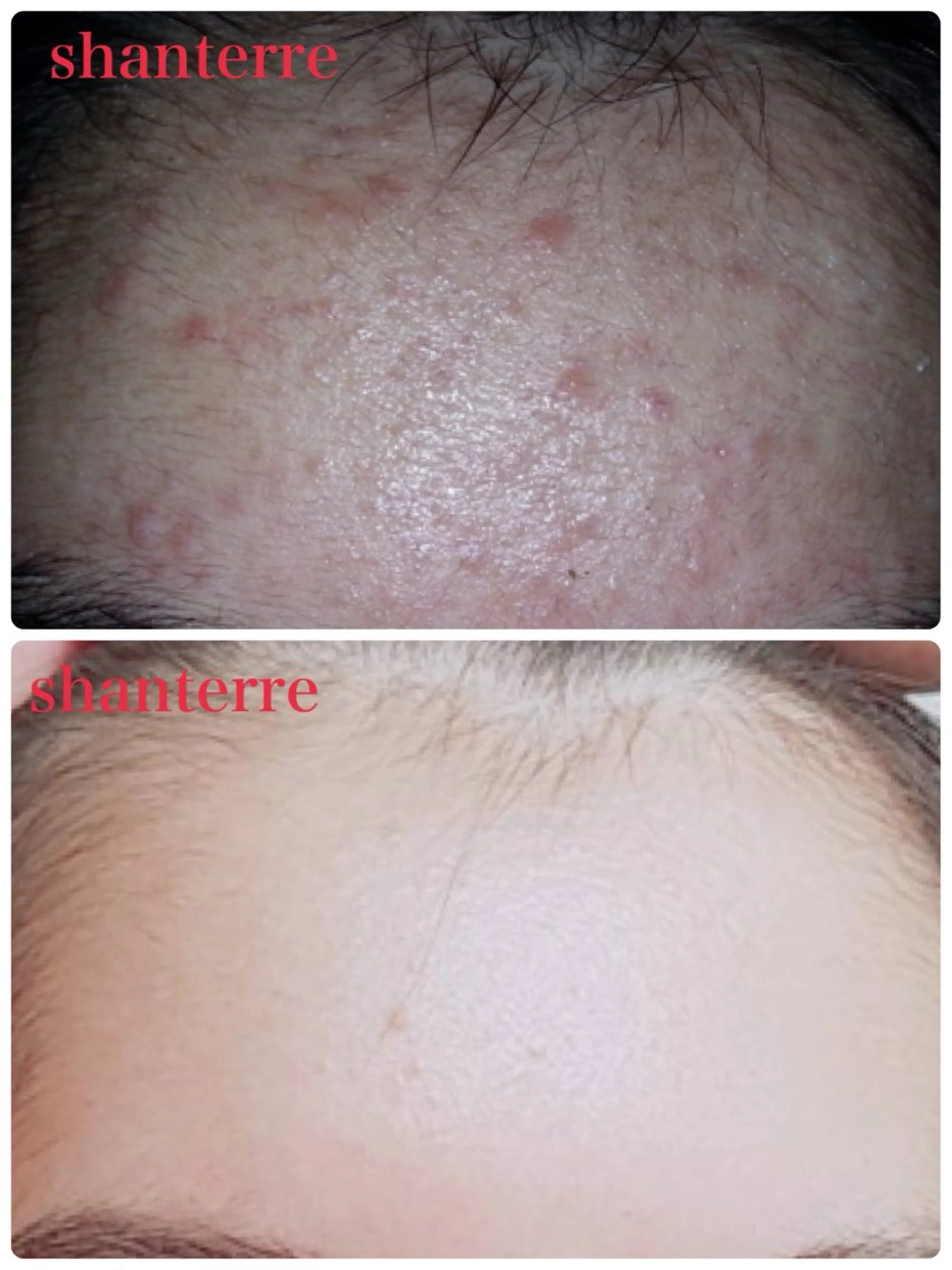 ピーリングサロン シャンテールのエステ・リラクイメージ