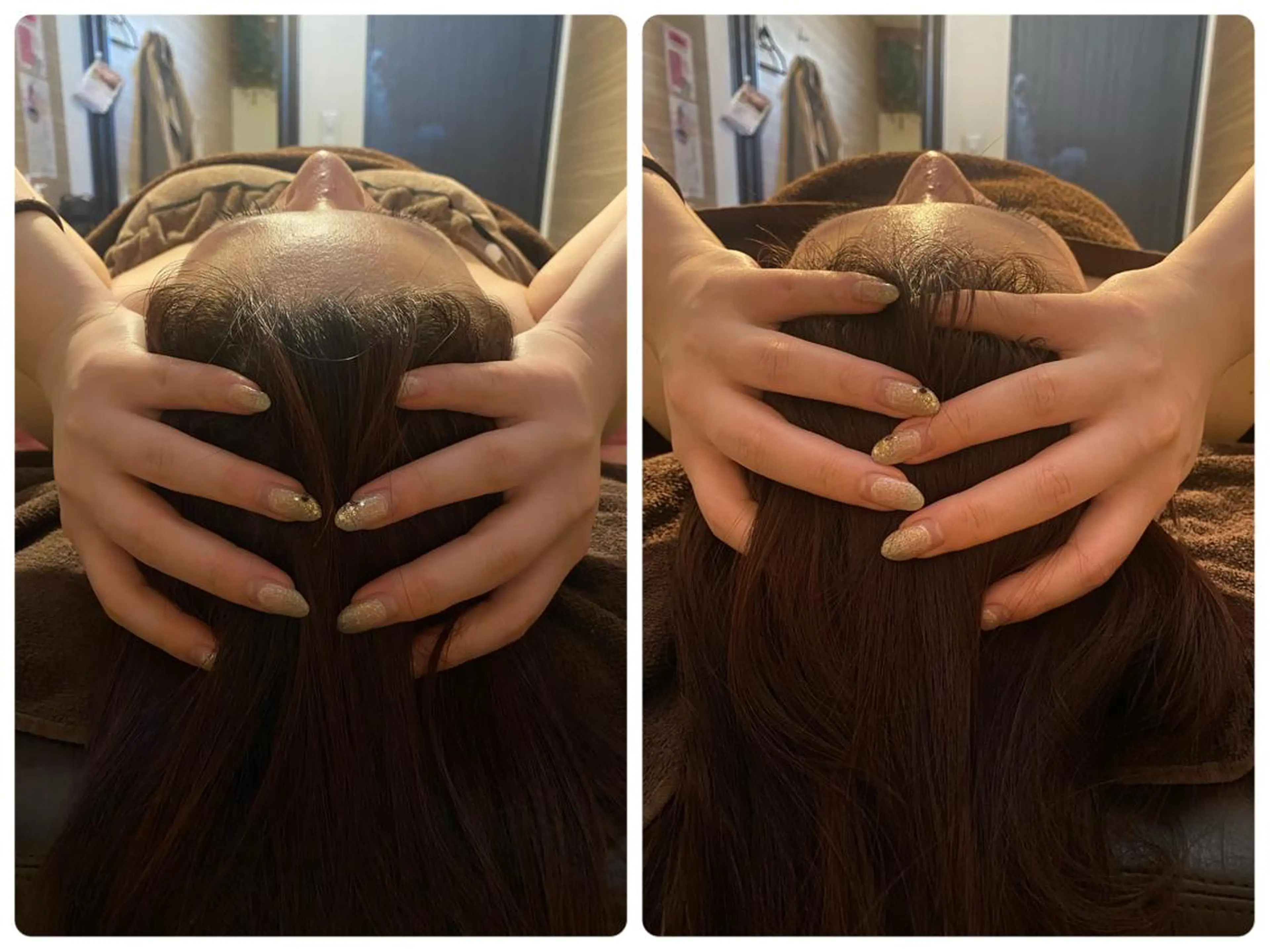 エステ リラク ハーブピーリング🌿 脱毛🧡ヘッドスパのエステ・リラクイメージ