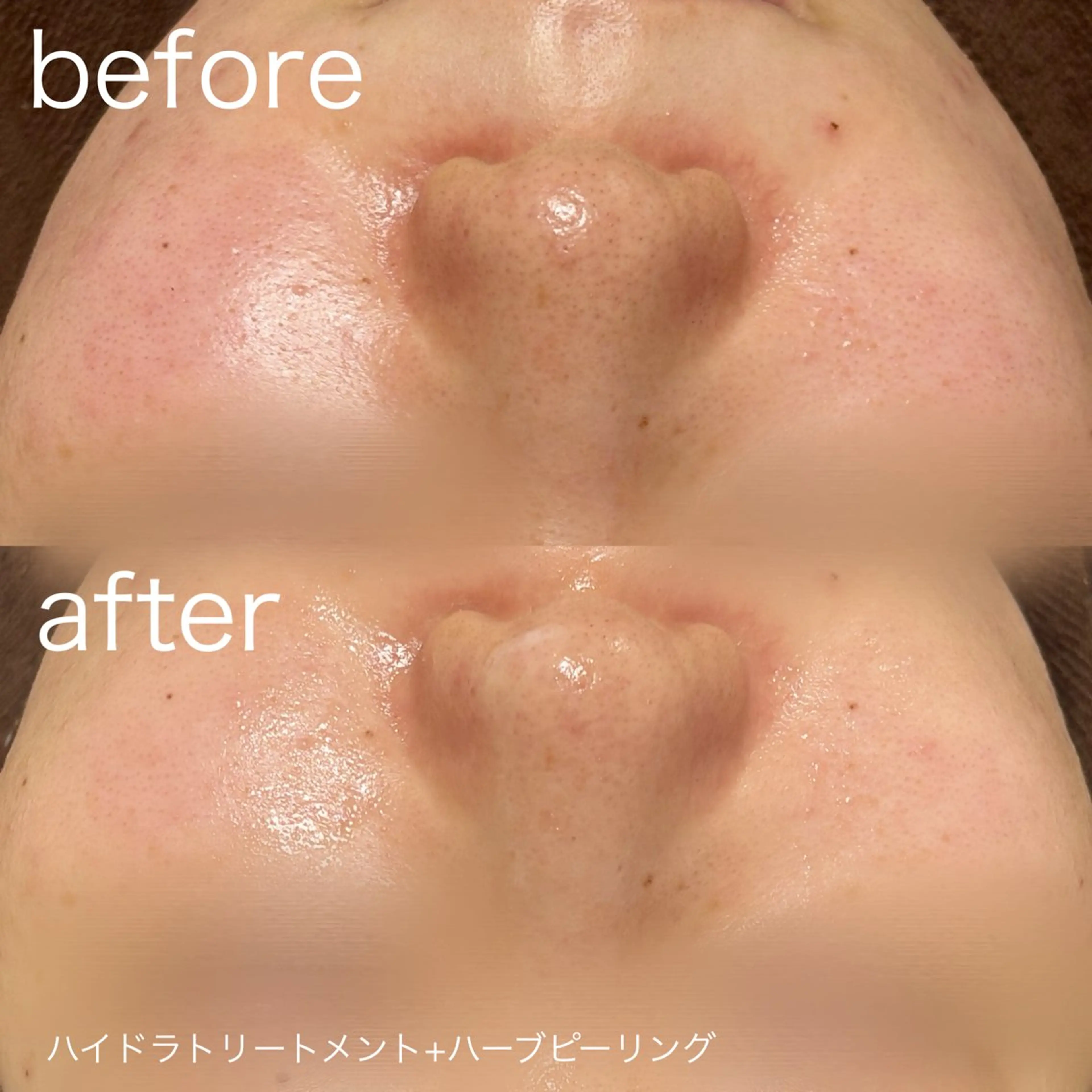 脱毛 lulularico Yuのエステ・リラクイメージ