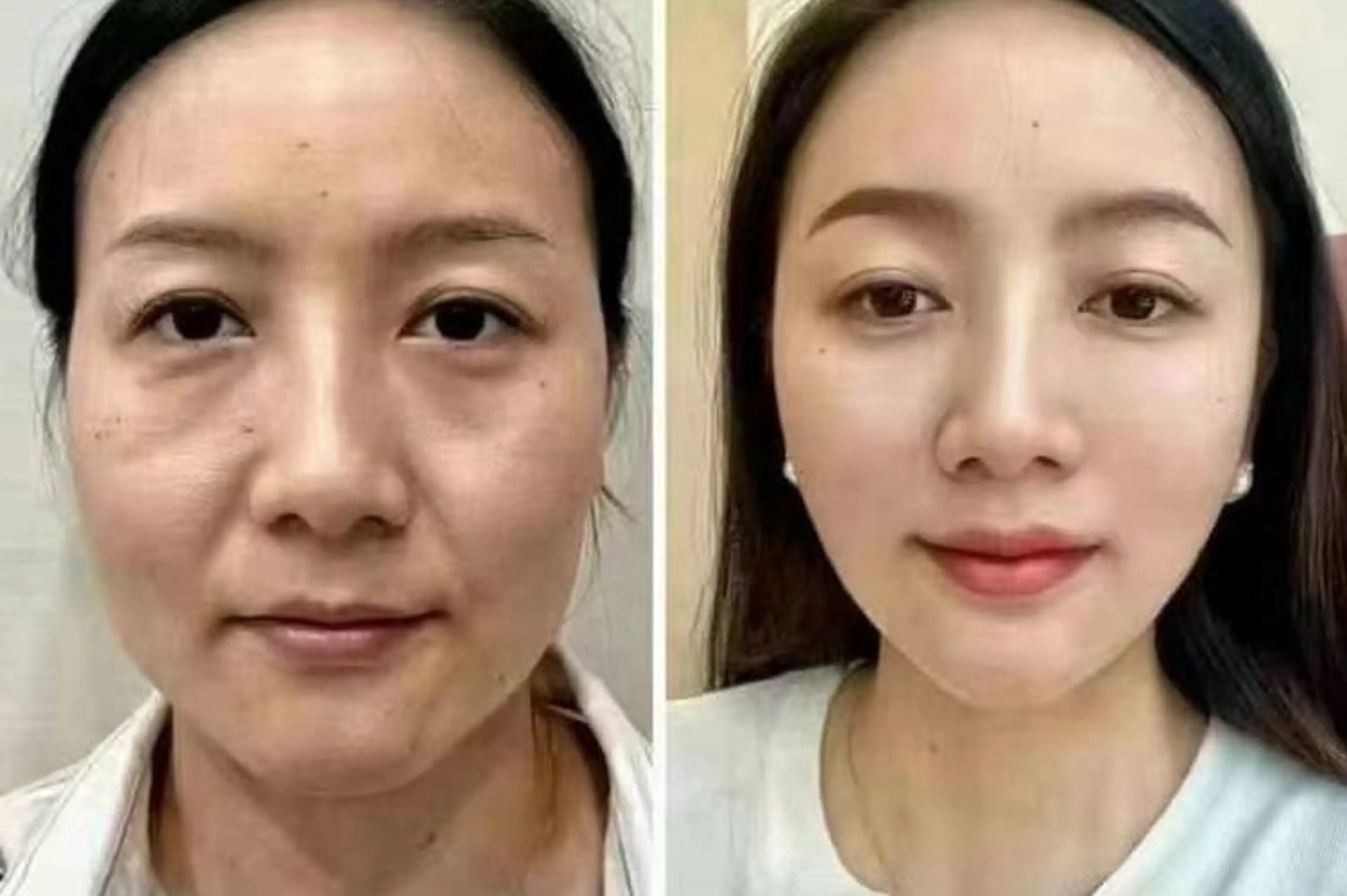 ネイル エステ aliaハイフ&水光ジェットサロン所属・aliaハーブ水光店 エステティシャン募集のエステ・リラクイメージ