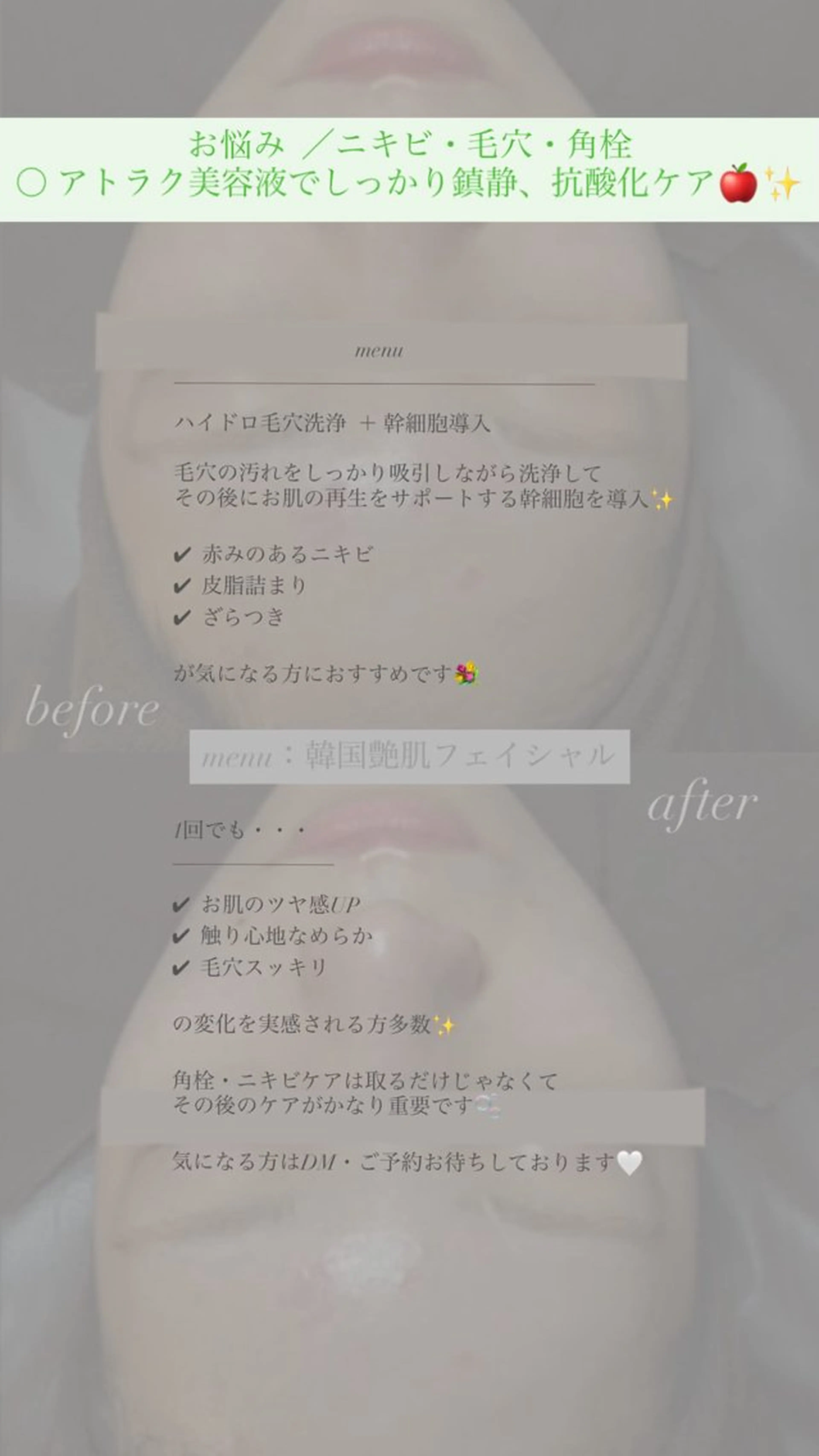 トータルボディケア chouchouのエステ・リラクイメージ