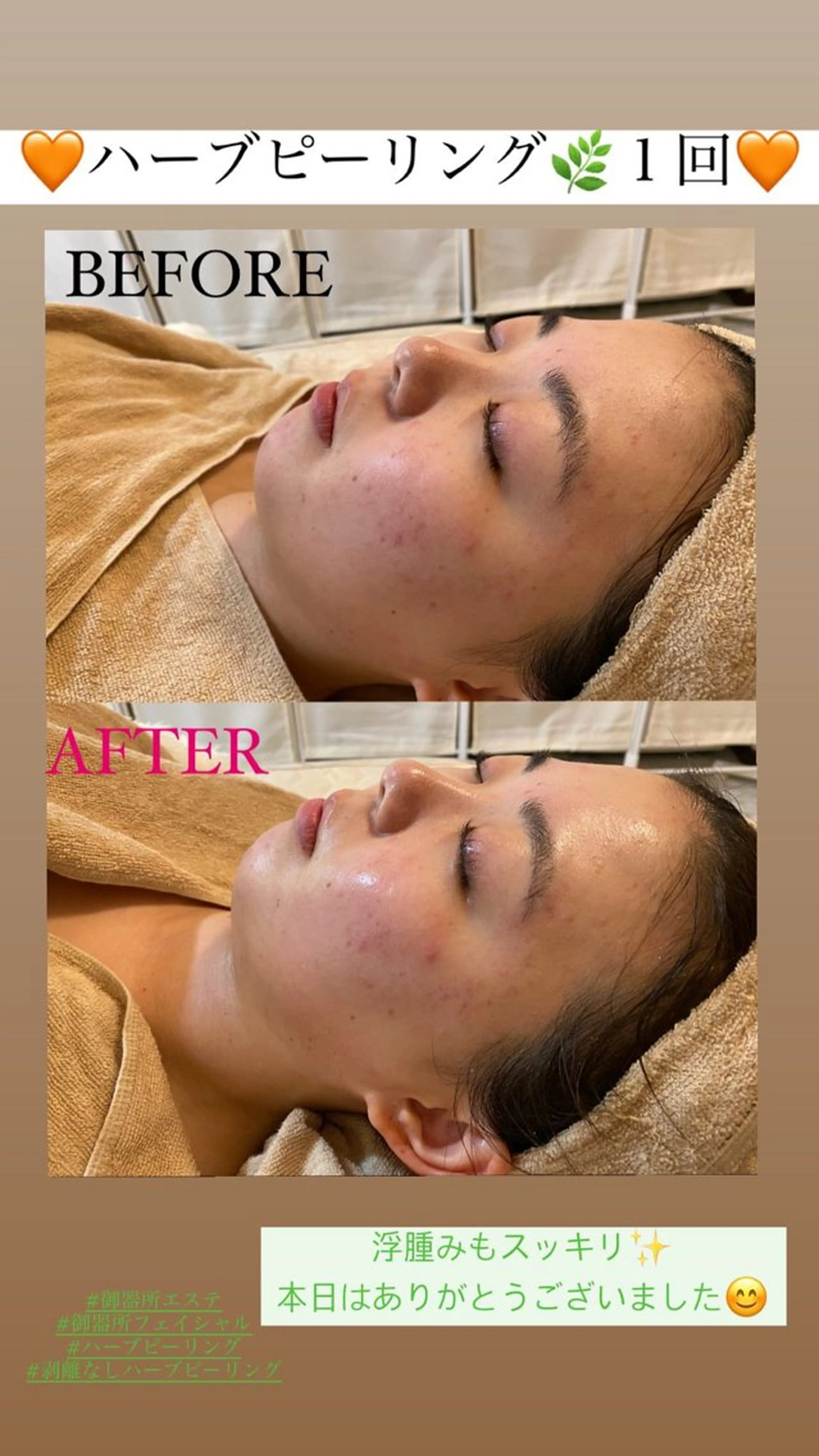 エステ Salon de Lino 御器所のエステ・リラクイメージ