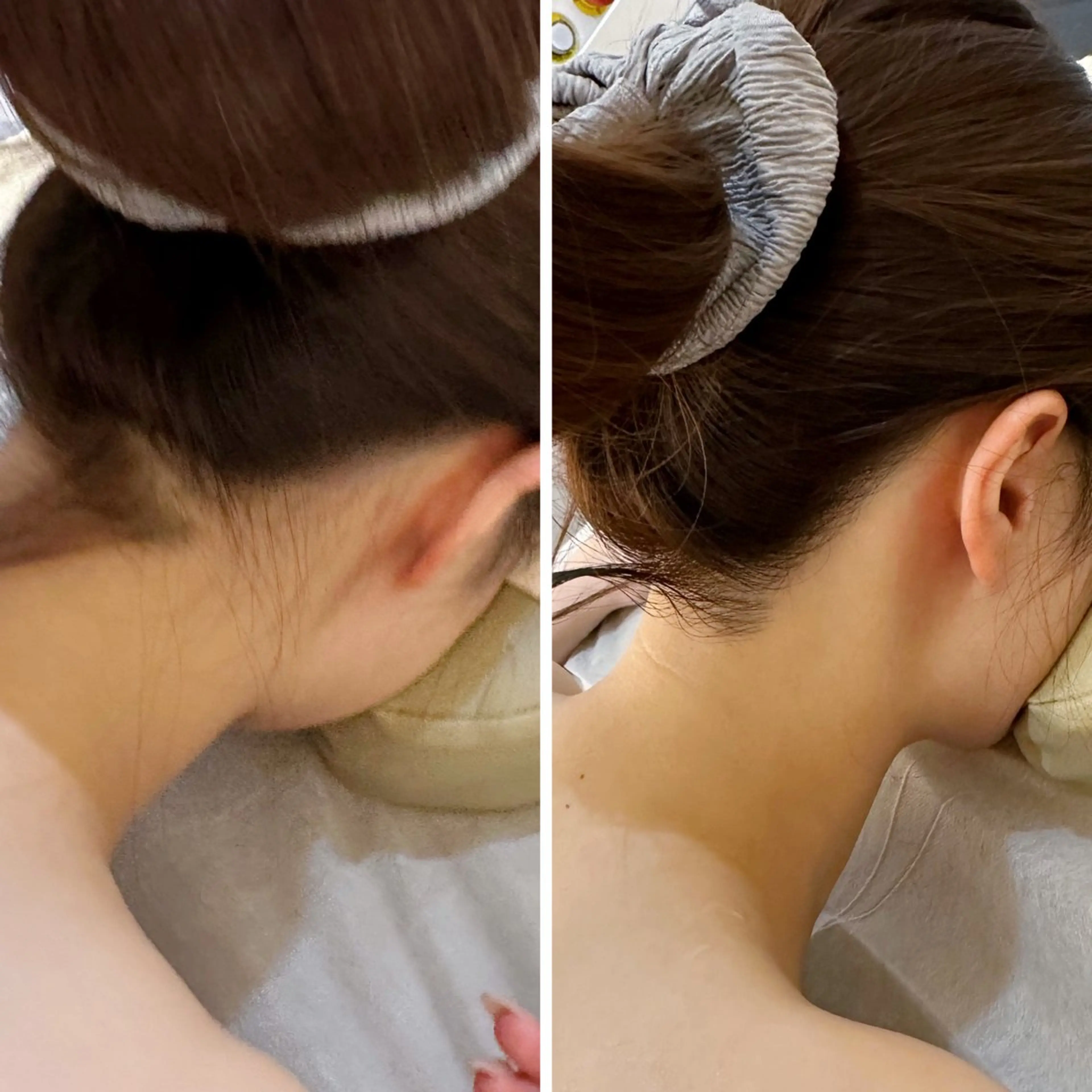 脱毛 うなじ脱毛/美肌脱毛 LABELのエステ・リラクイメージ