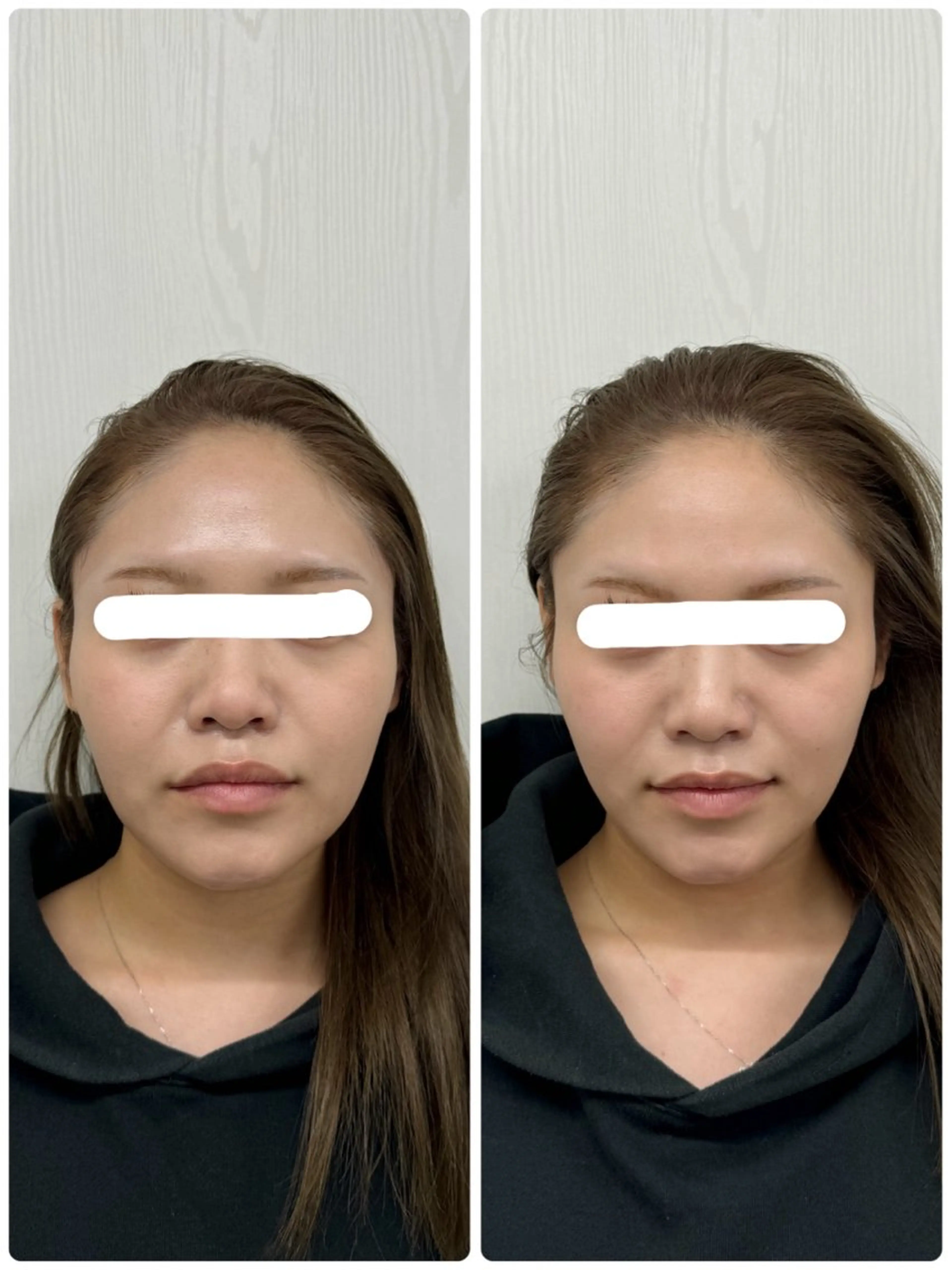 エステ リラク 美容鍼×小顔矯正 ×美容整体　浜川泰仁のエステ・リラクイメージ