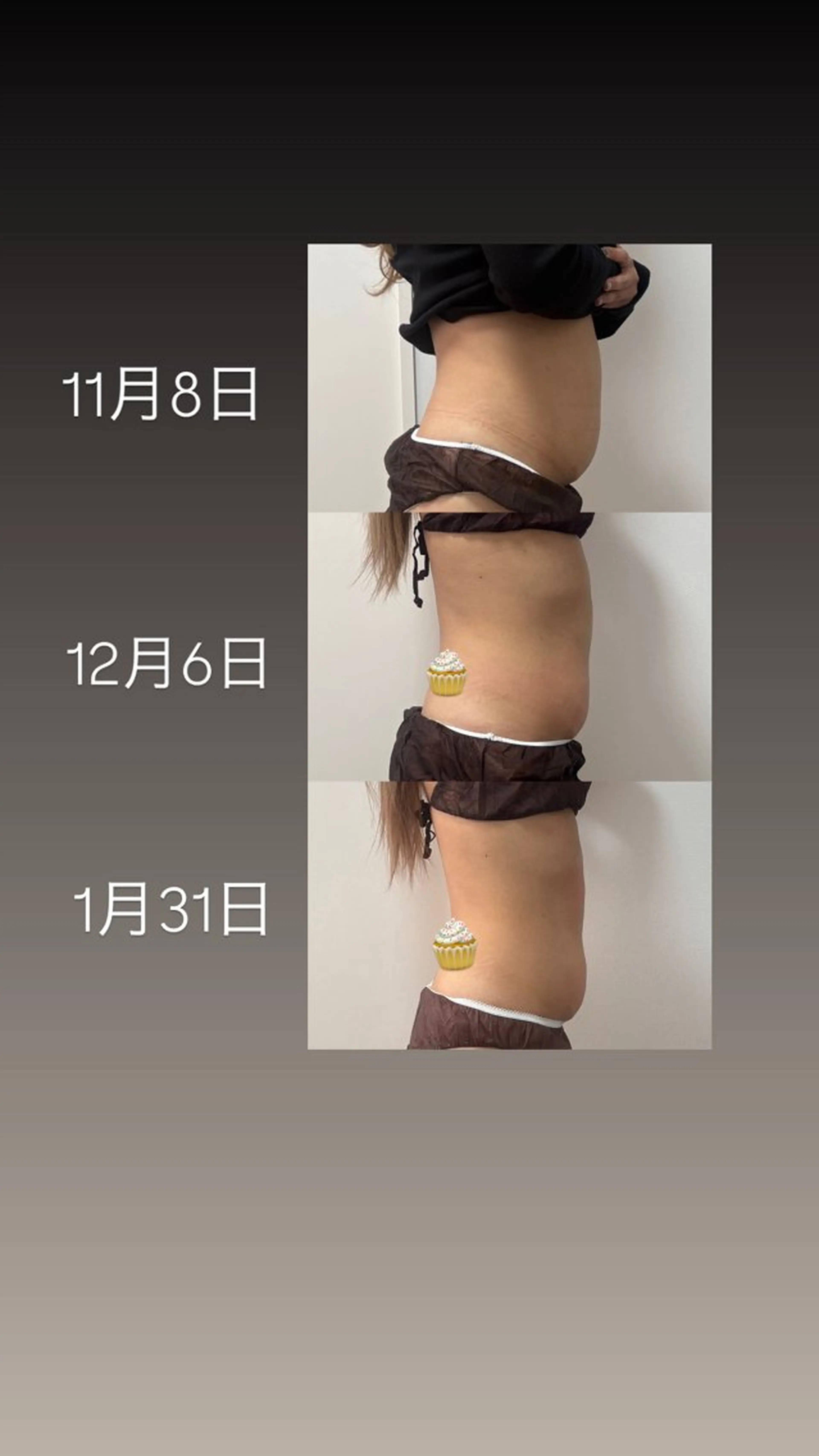 エステ 石巻 冷却痩身 Miiju. 鈴木のエステ・リラクイメージ