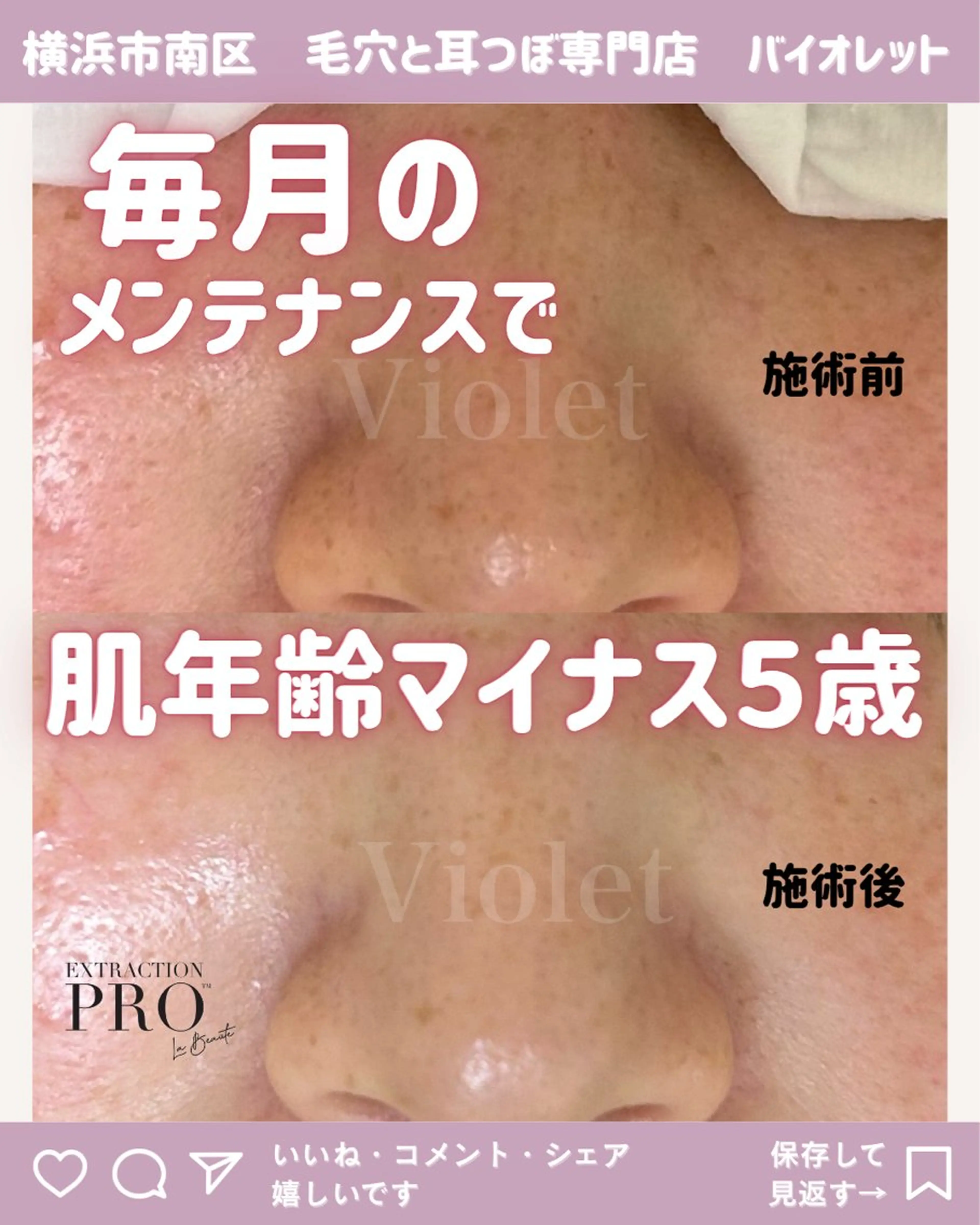 その他 毛穴と耳つぼ専門店 バイオレット　りののその他イメージ