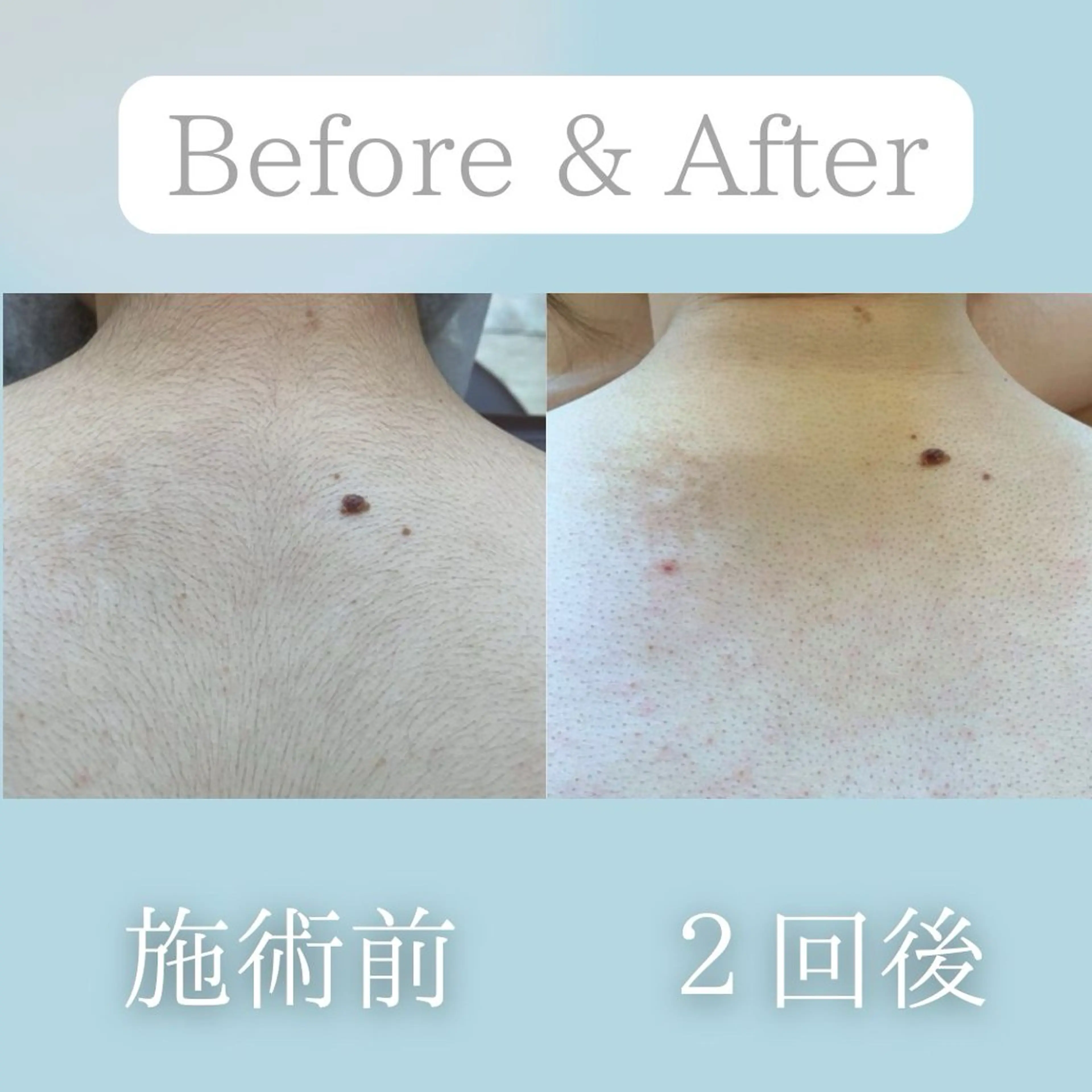 美肌脱毛&毛穴専門 Nico🐰ྀི♡のエステ・リラクイメージ