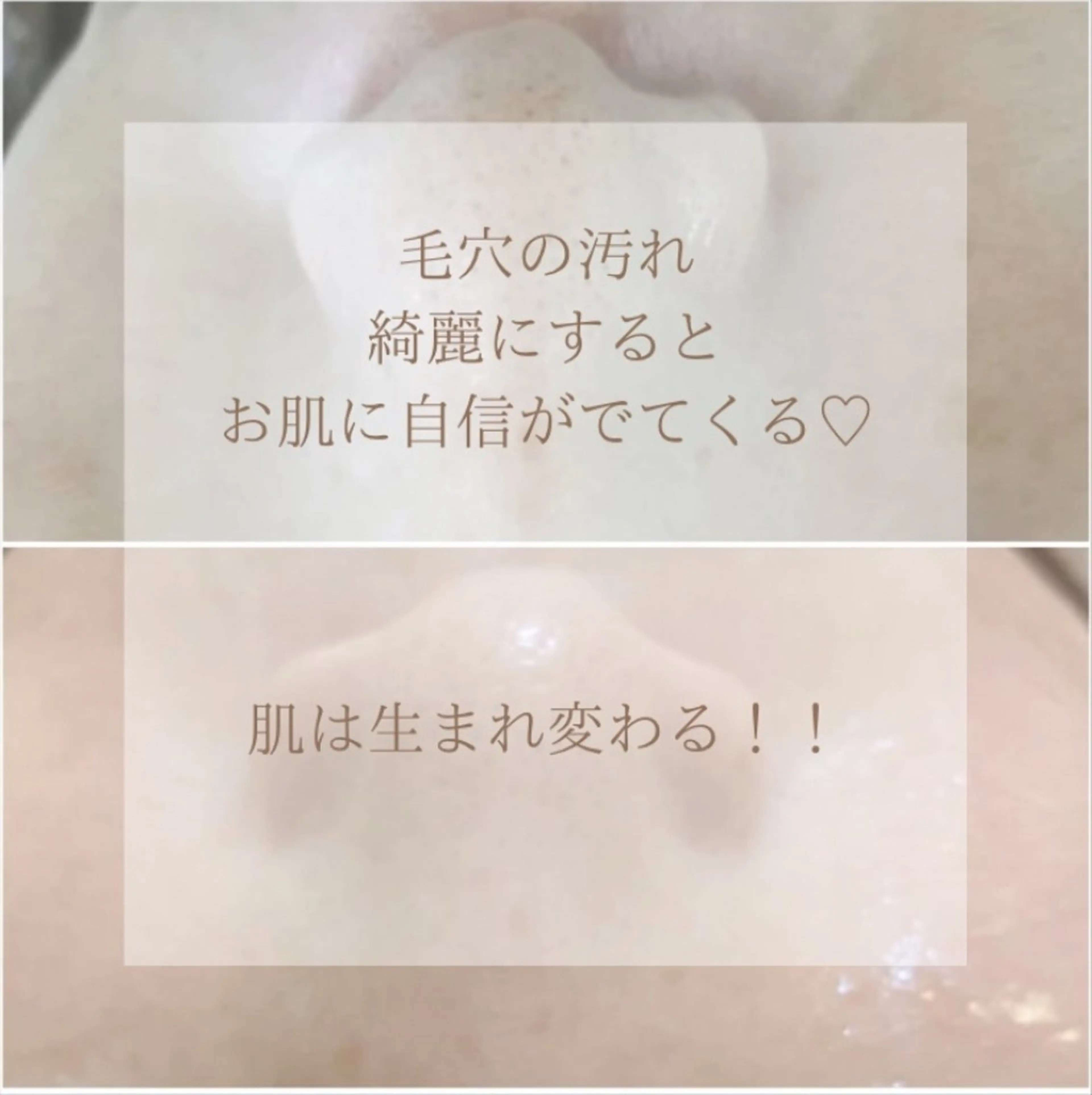 エステ フェイシャル/毛穴 /シミ/たるみ東灘区のエステ・リラクイメージ