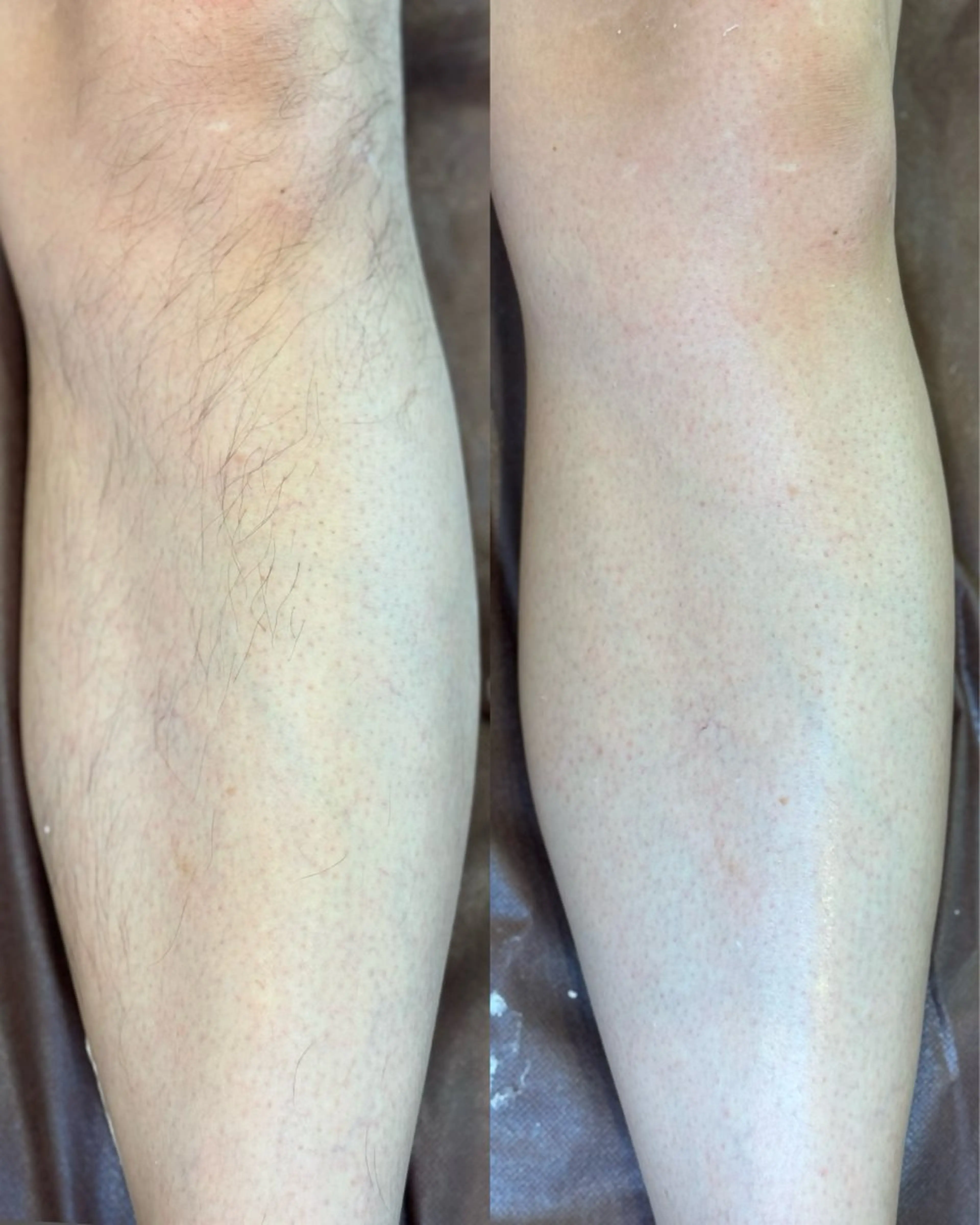 【ひざ下WAX脱毛】ツルスベ美脚への写真