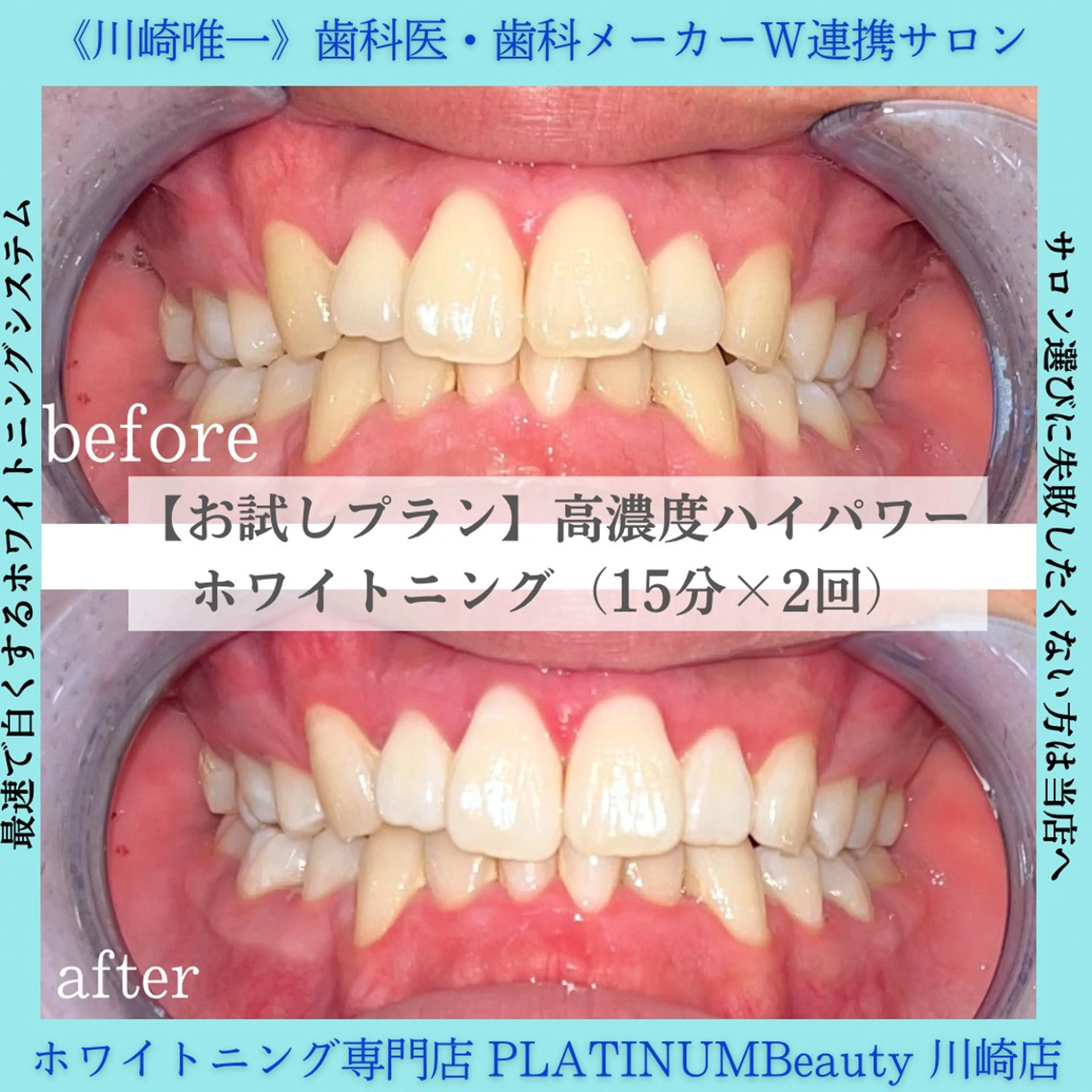 PLATINUM Beauty 川崎店のエステ・リラクイメージ