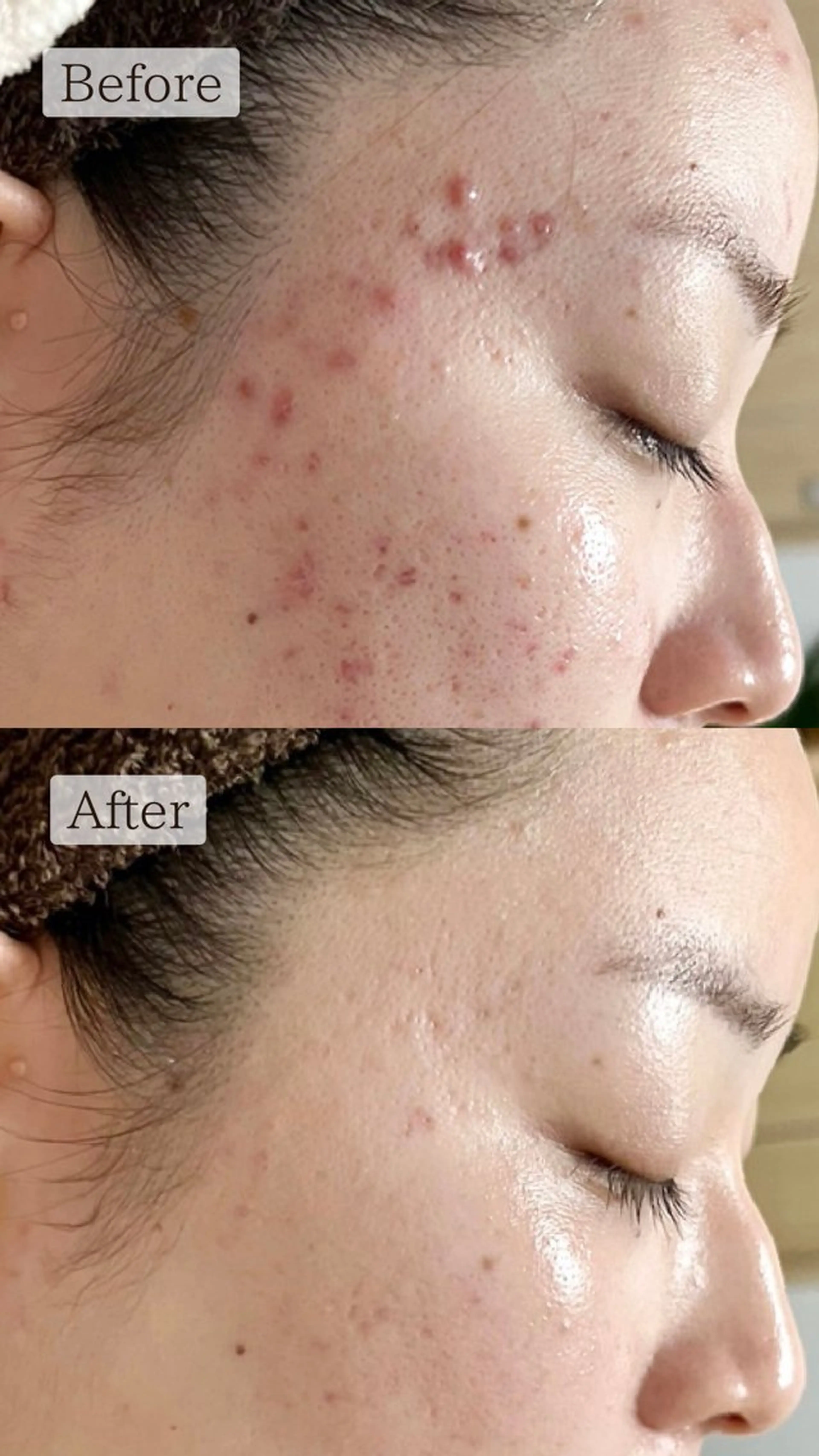 肌質改善専門サロン Bellmi/心斎橋のエステ・リラクイメージ