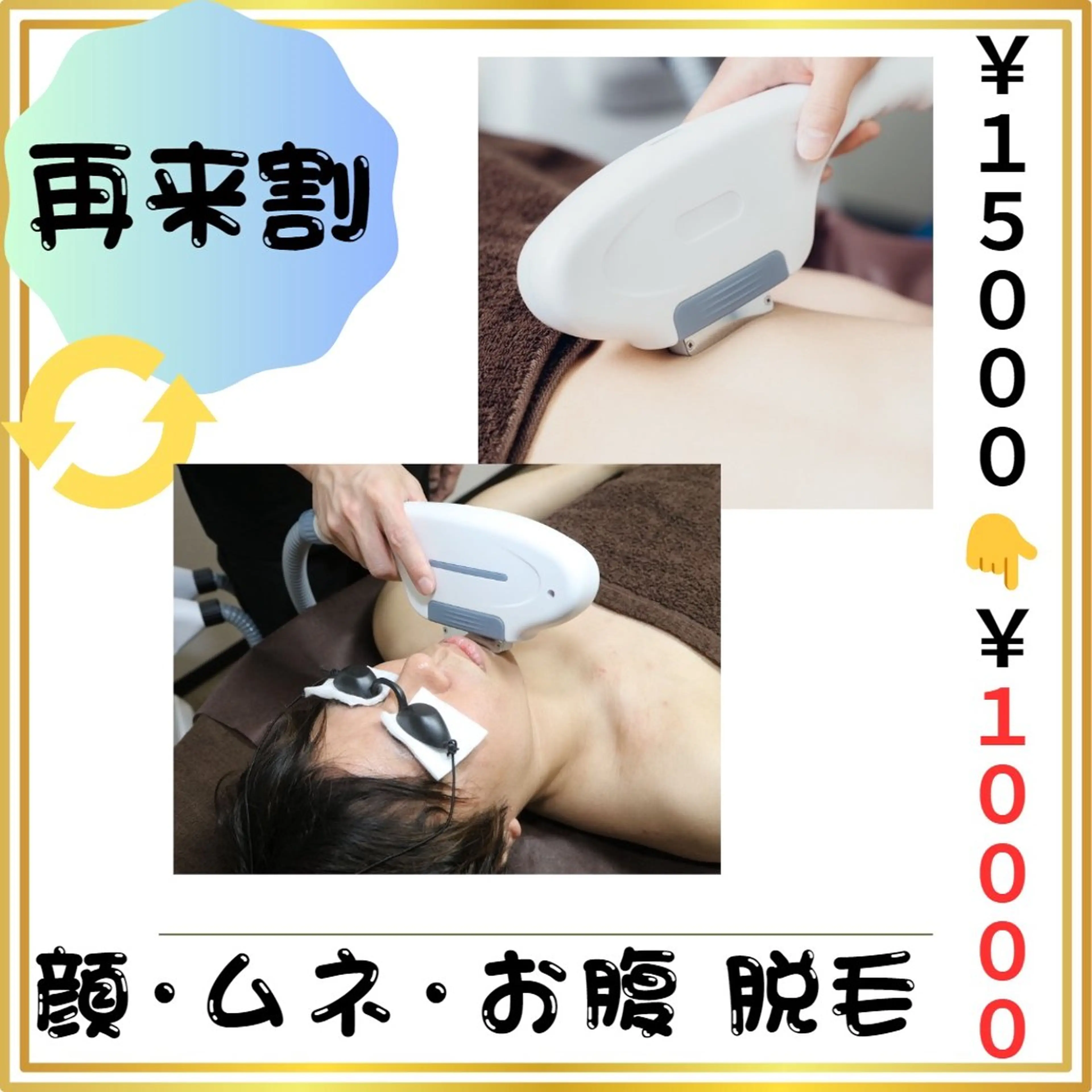 🔄再来割🔄【顔・胸・お腹 脱毛】 (#メンズ脱毛 #女性ウケ◎  #清潔感  #都度払い)の写真