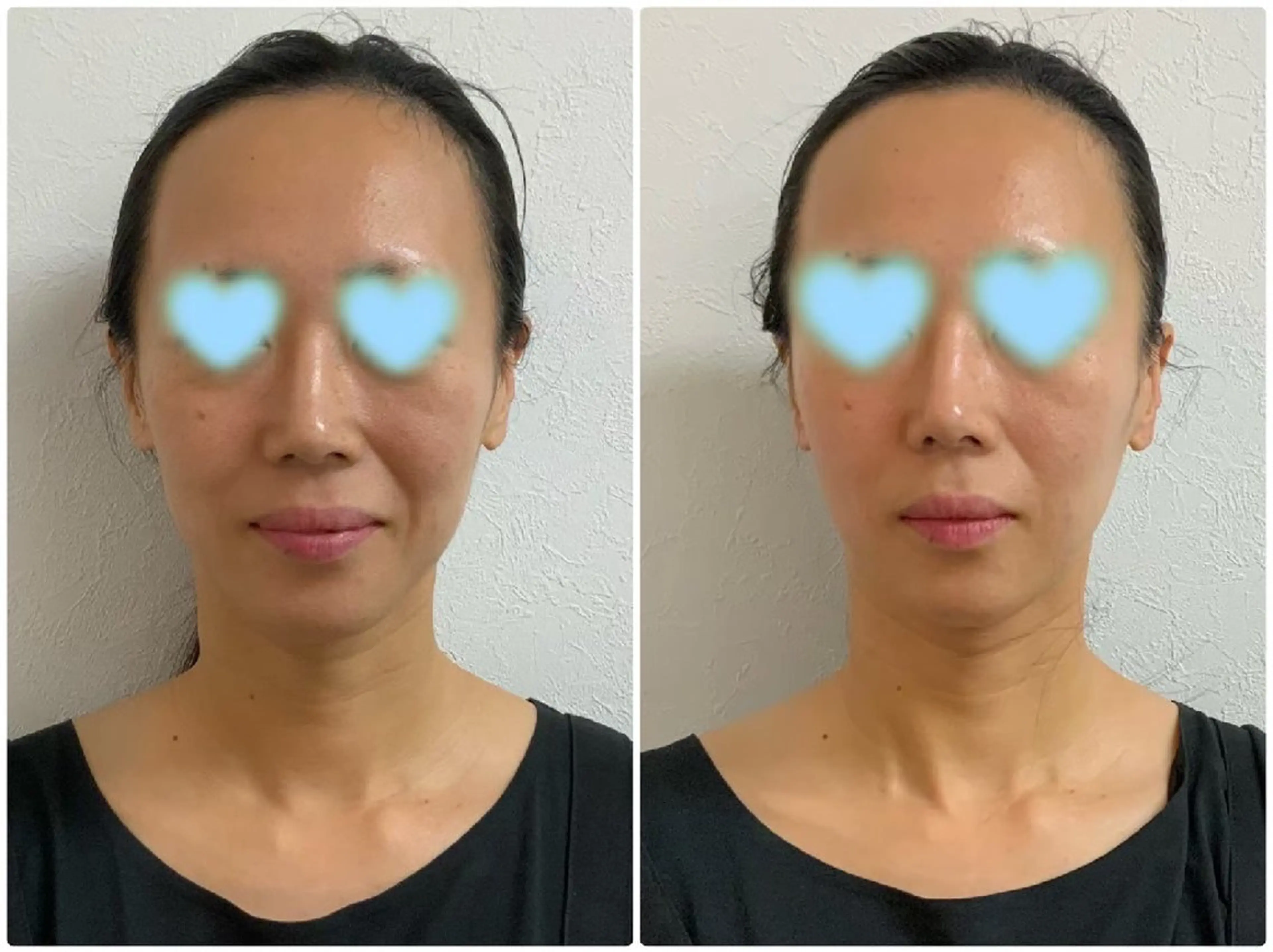 Prima（プリマ） 名古屋駅本店のエステ・リラクイメージ